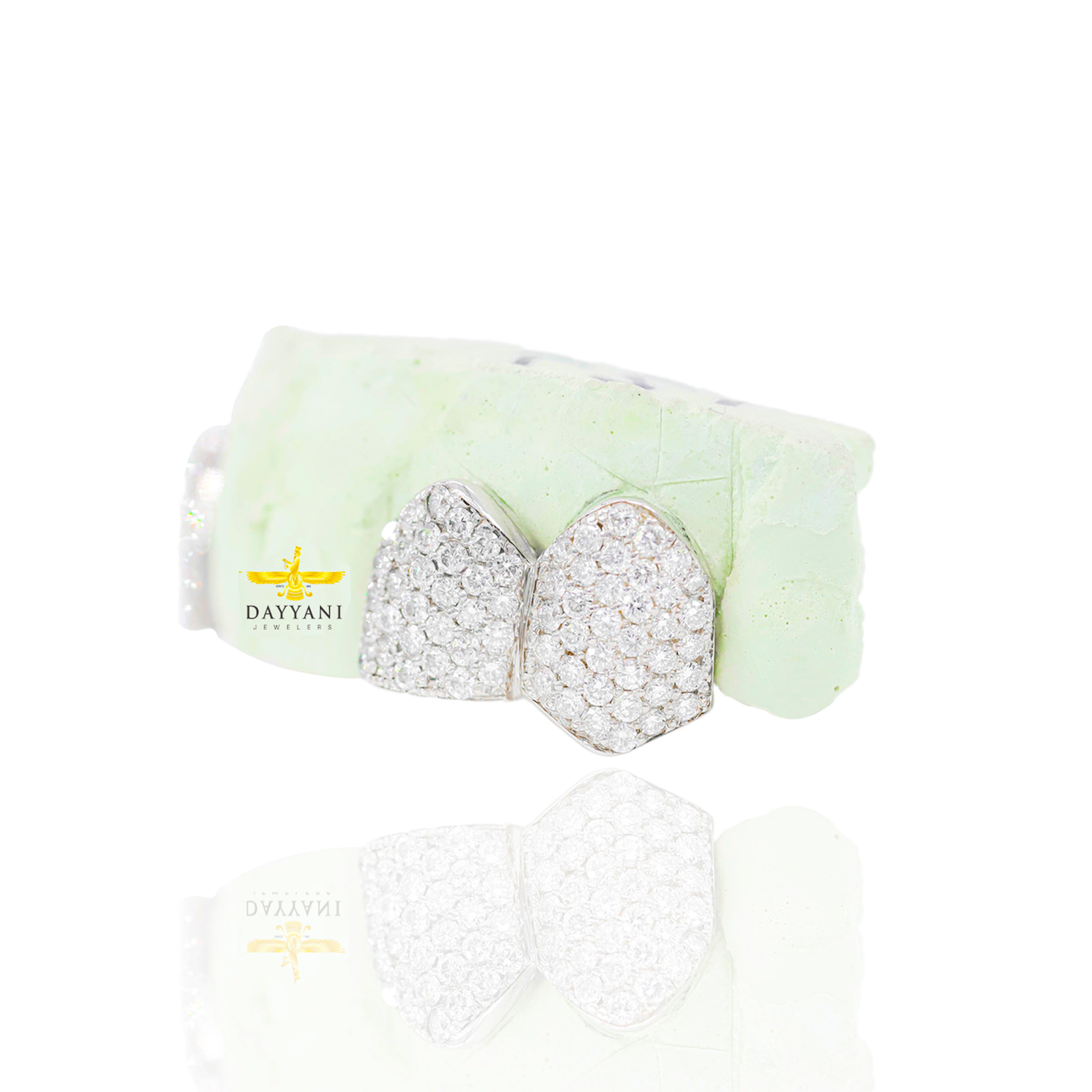 Custom 4 Teeth Diamond Grillz with Back Bar Gold Grillz