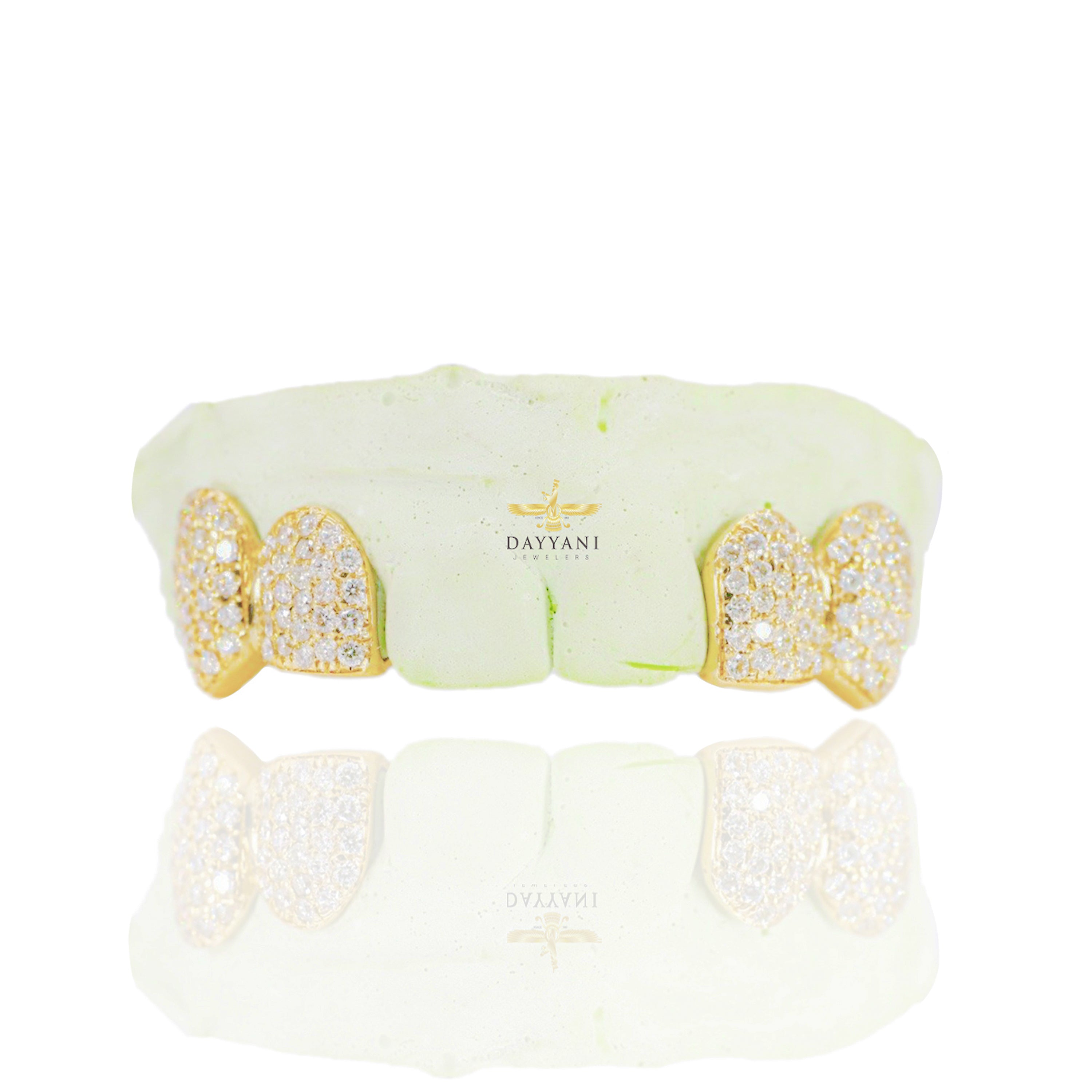 Custom 4 Teeth Diamond Grillz with Back Bar Gold Grillz