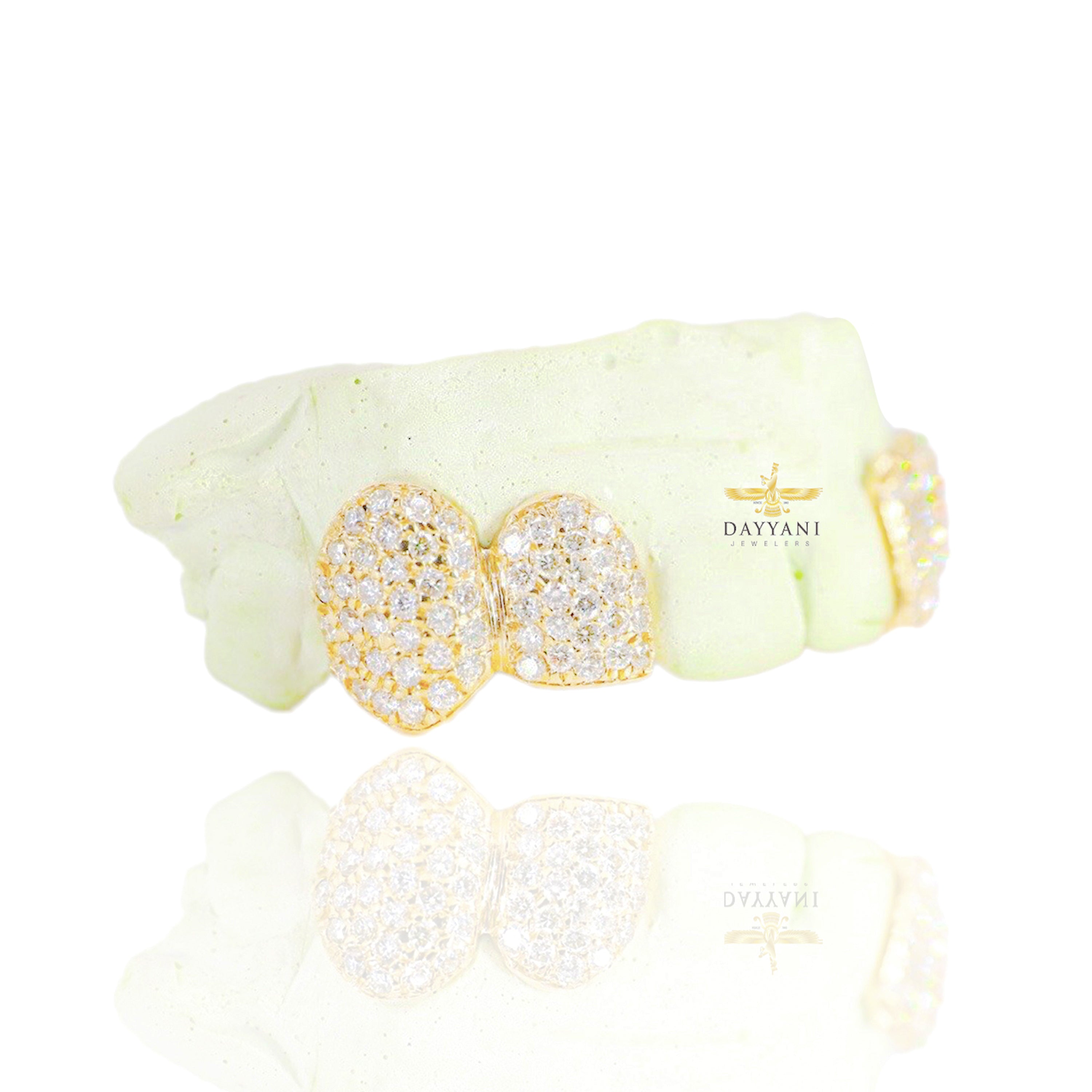 Custom 4 Teeth Diamond Grillz with Back Bar Gold Grillz