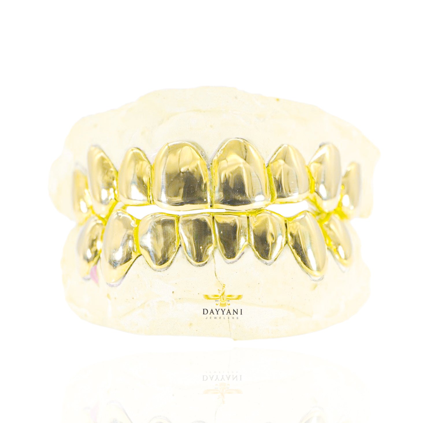 Custom 8 on 8 Gold Grillz