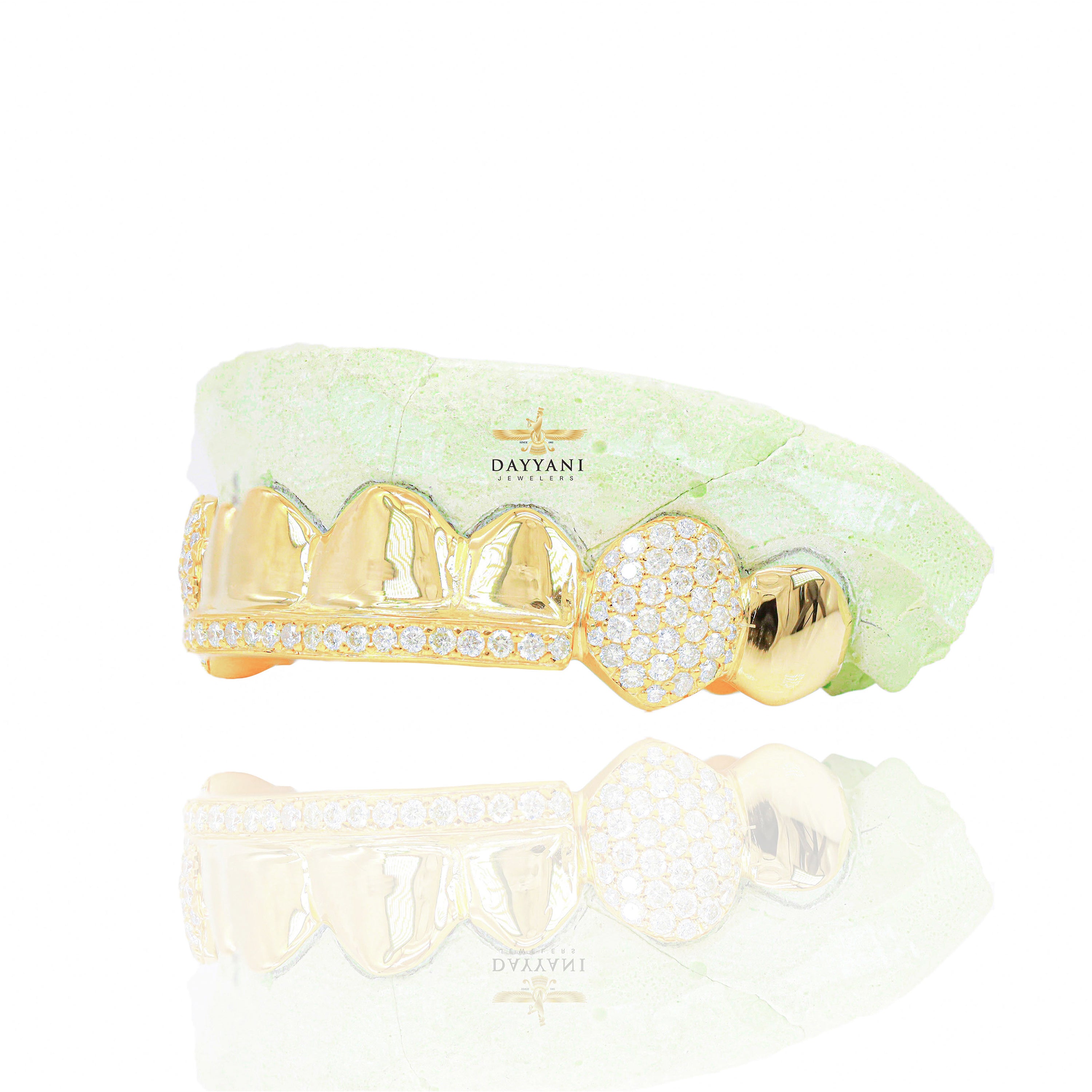 Custom 8 Teeth Grillz with Diamond on Fangs and Diamond Bar Gold Grillz