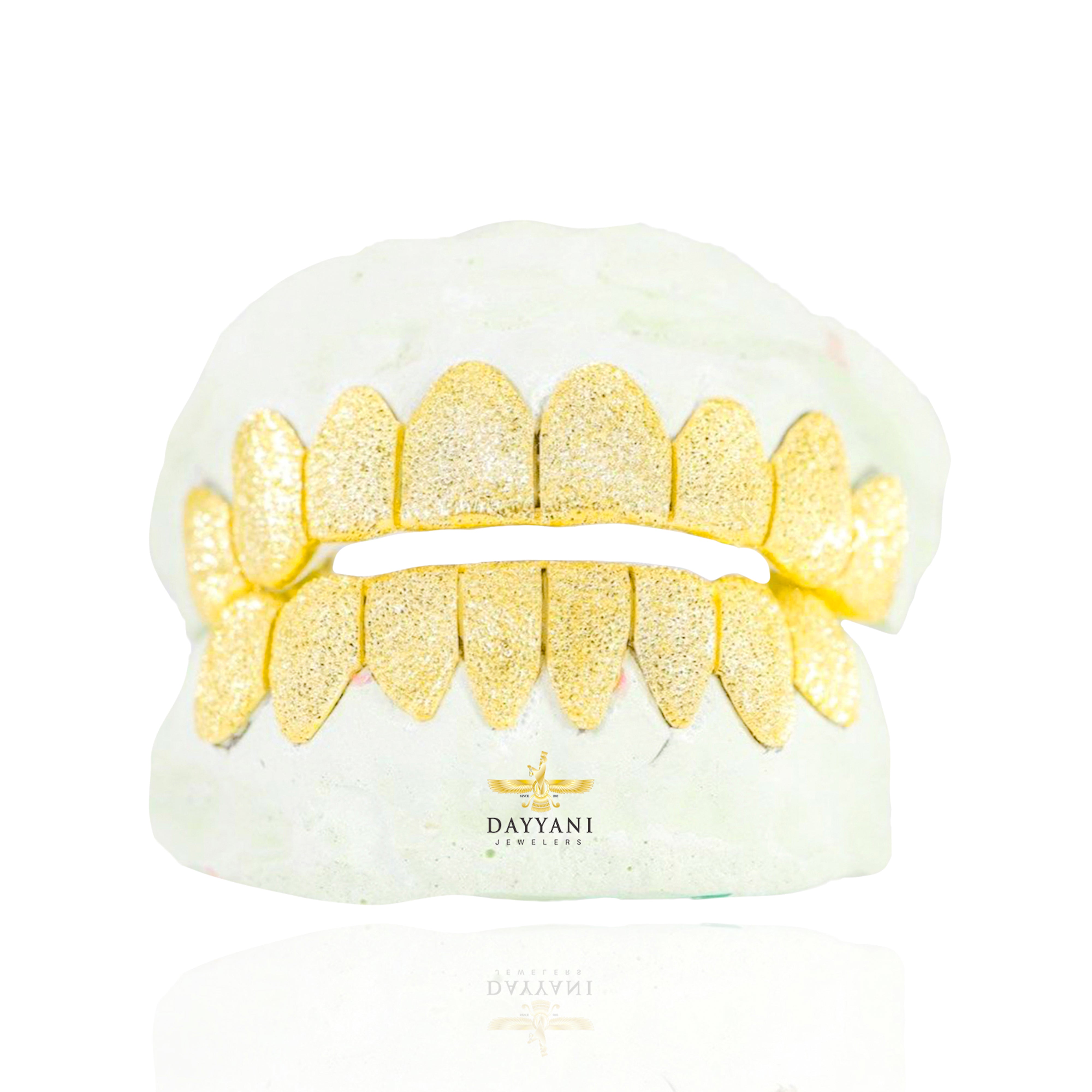 Custom Diamond Dust Gold Grillz