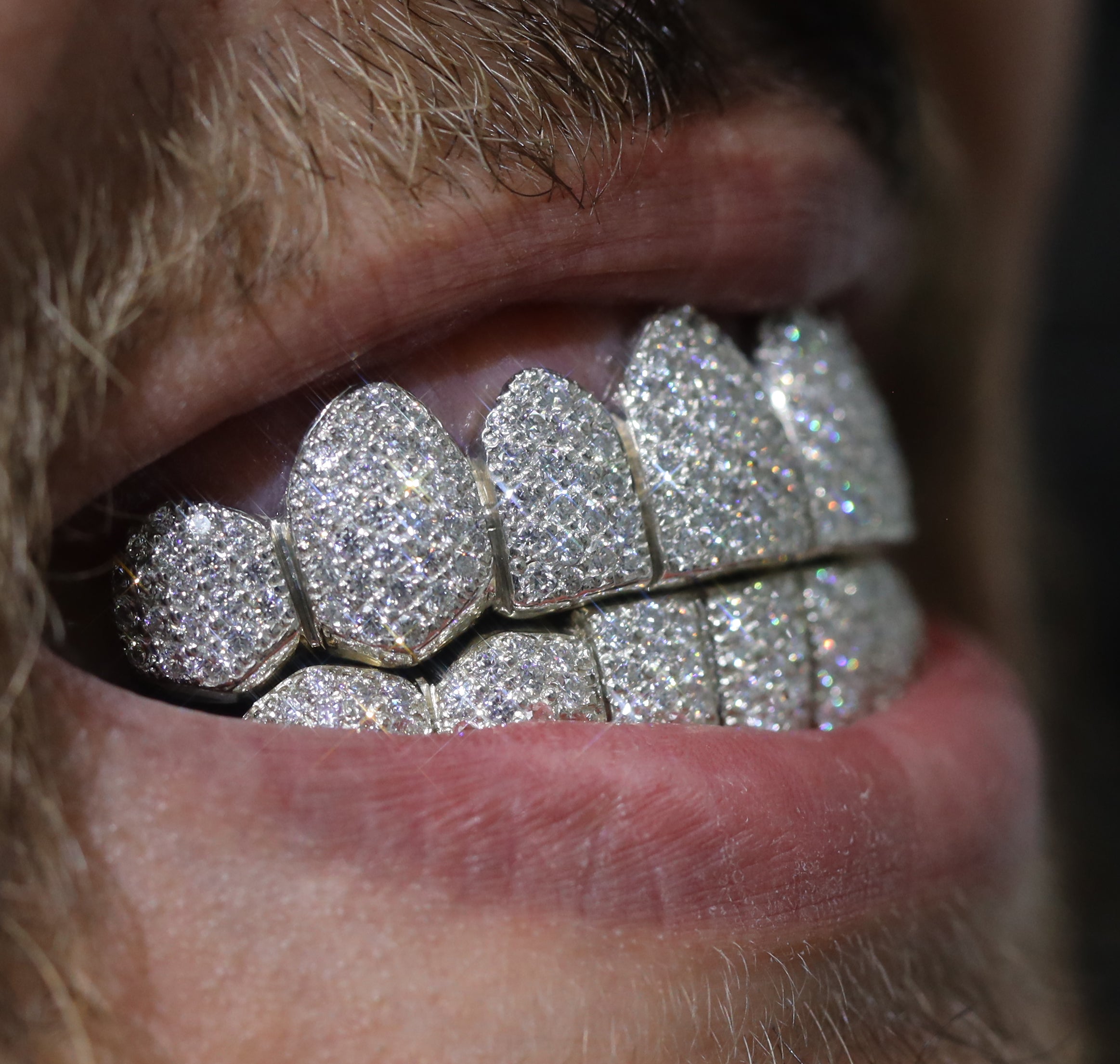 Custom SI Clarity Diamond Grillz Hand Set Natural Diamonds Gold Grillz (Zig-Zag Setting)