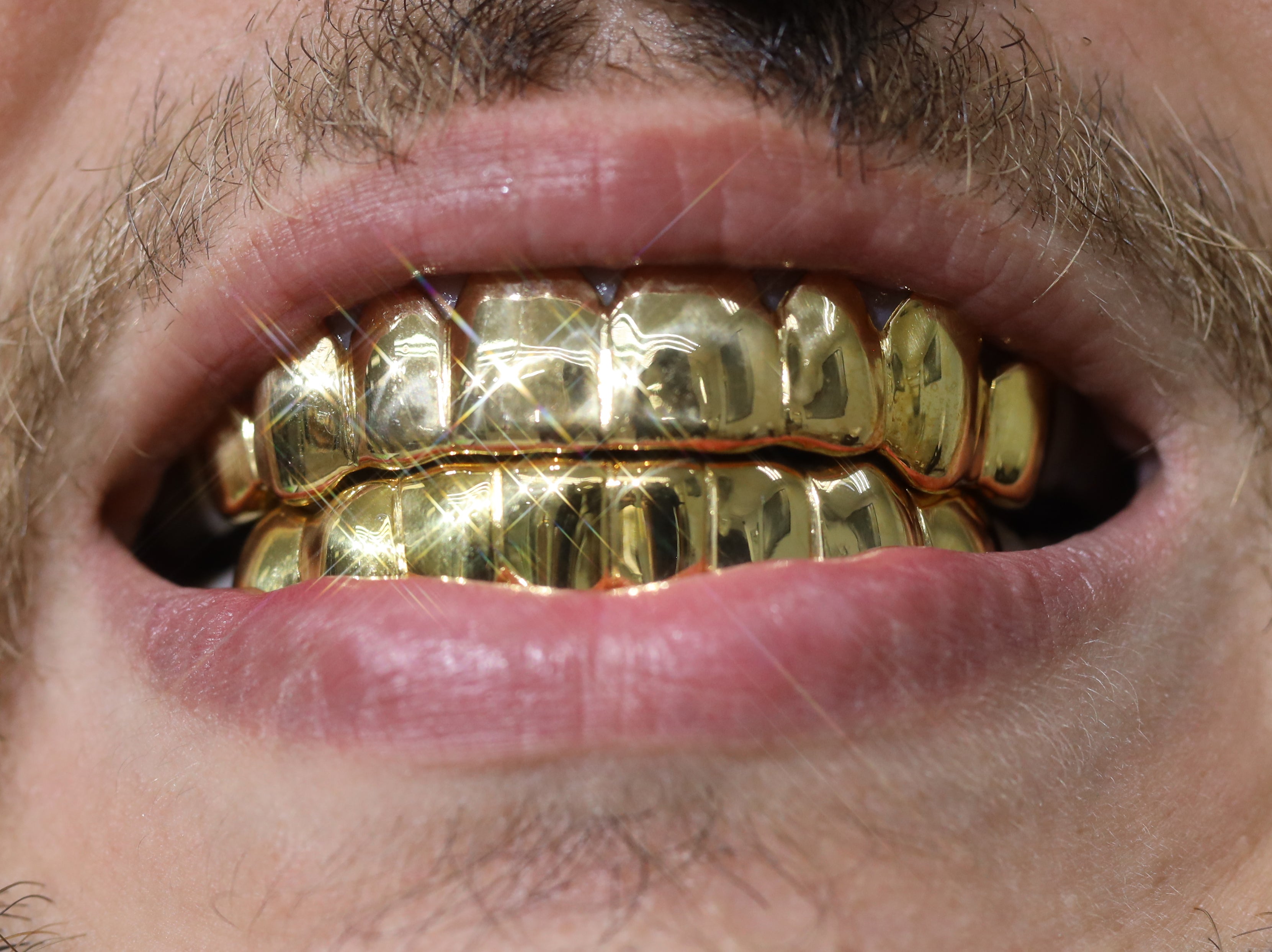 Custom Grillz Solid Gold Grillz