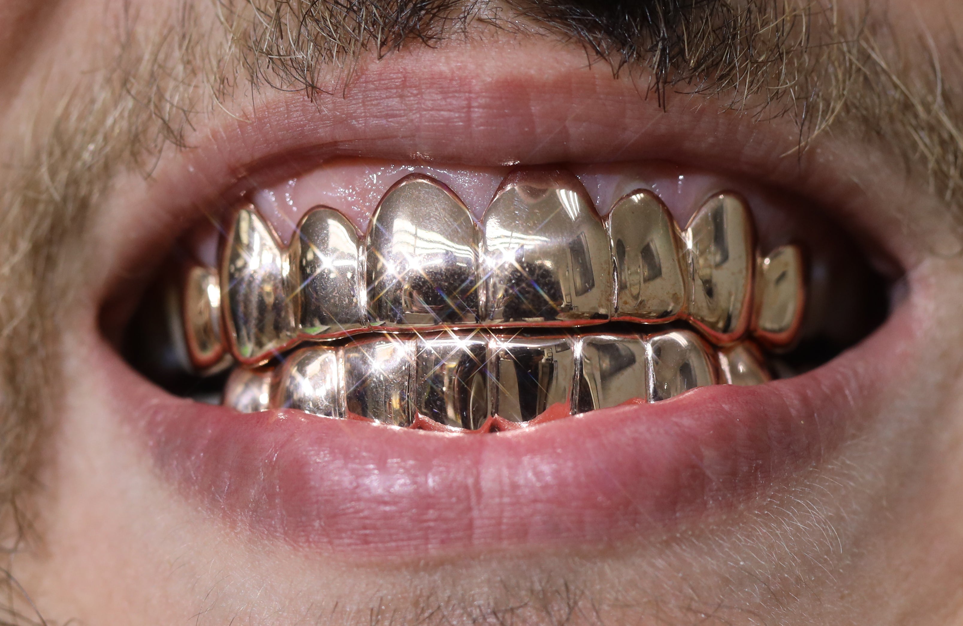 Custom 8 on 8 Gold Grillz