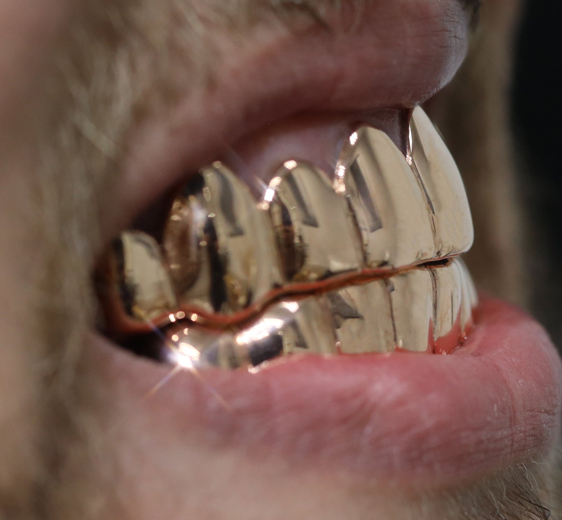 Custom Grillz Solid Gold Grillz