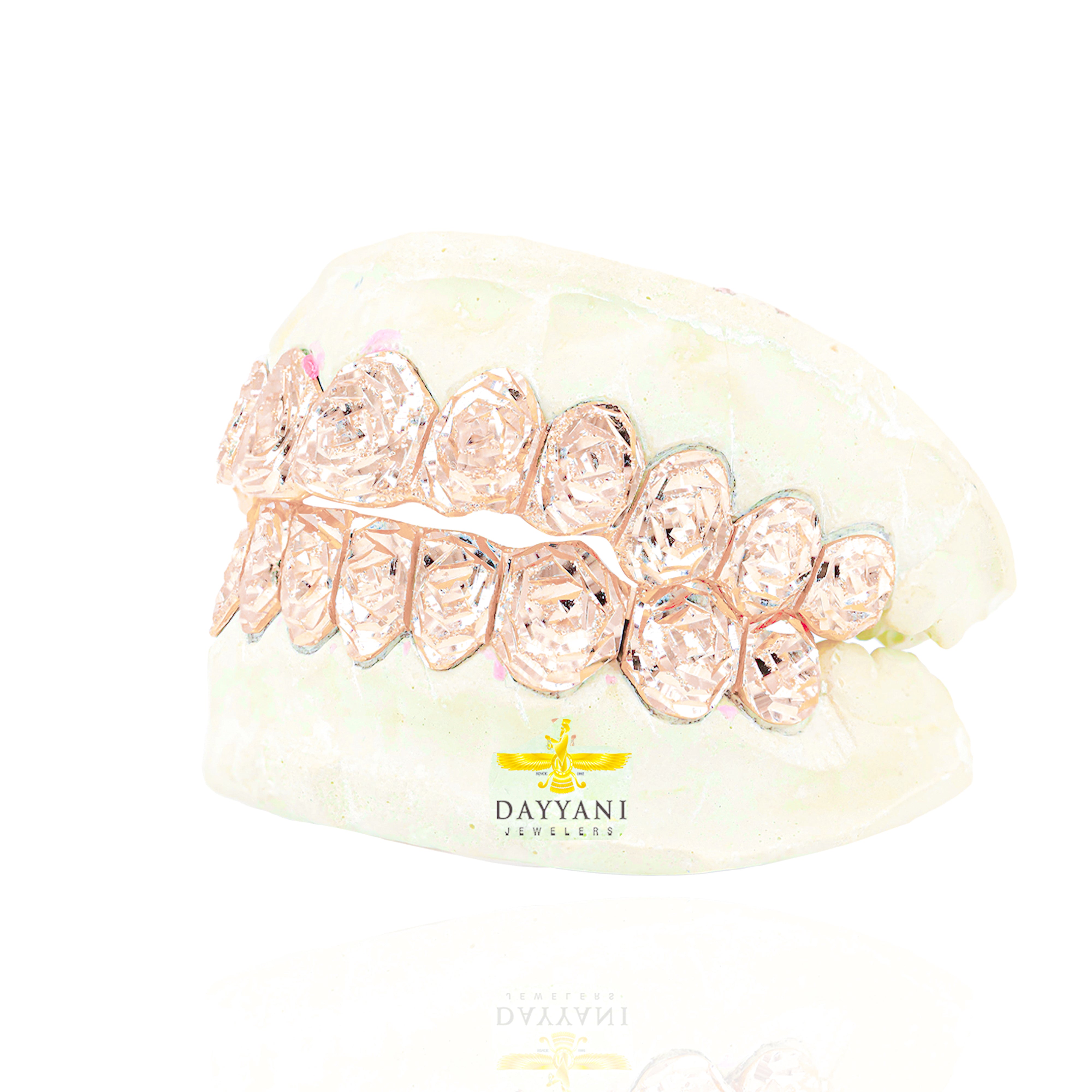 Custom Rose Cut & Diamond Dust Gold Grillz
