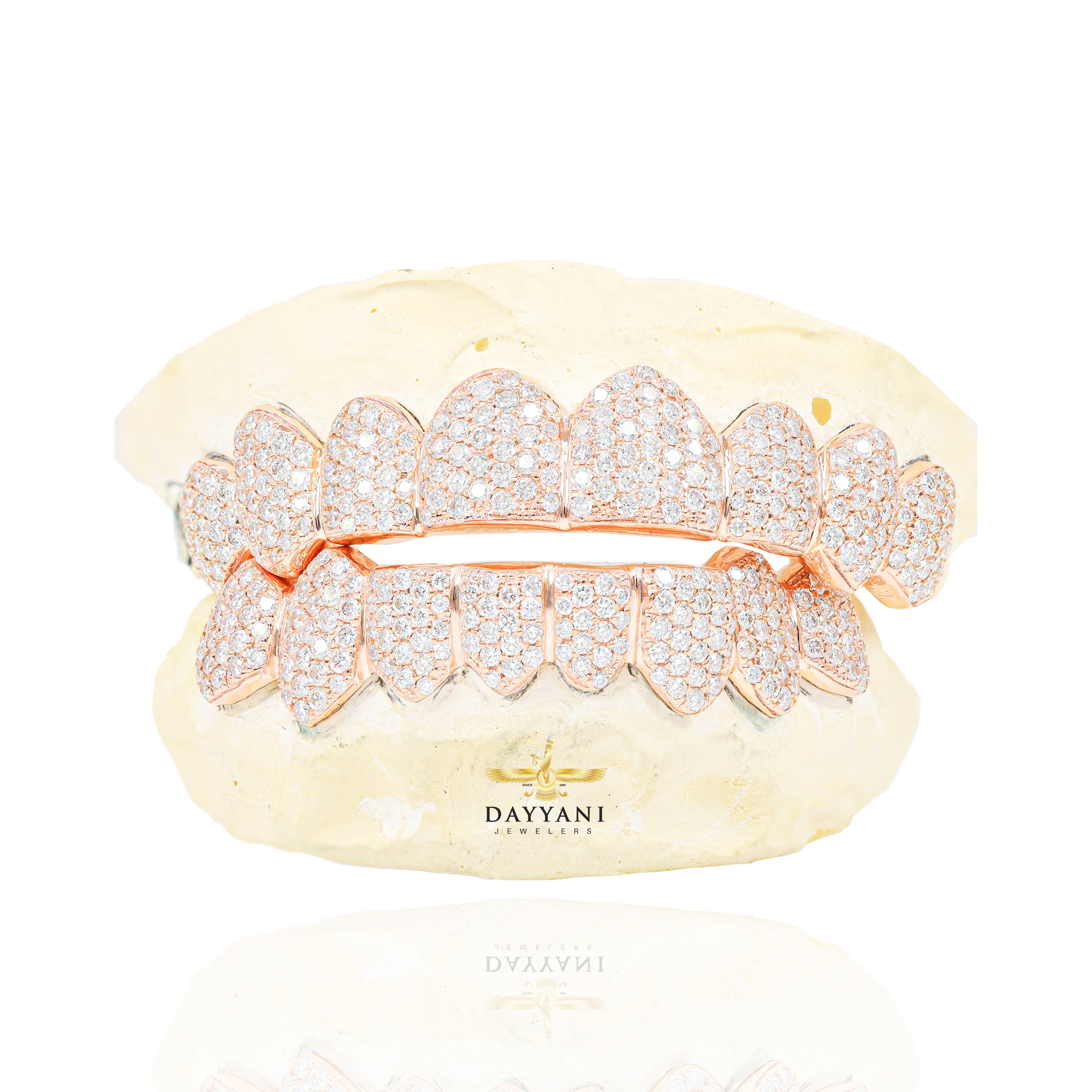Custom SI Clarity Diamond Grillz Hand Set Natural Diamonds Gold Grillz (Zig-Zag Setting)