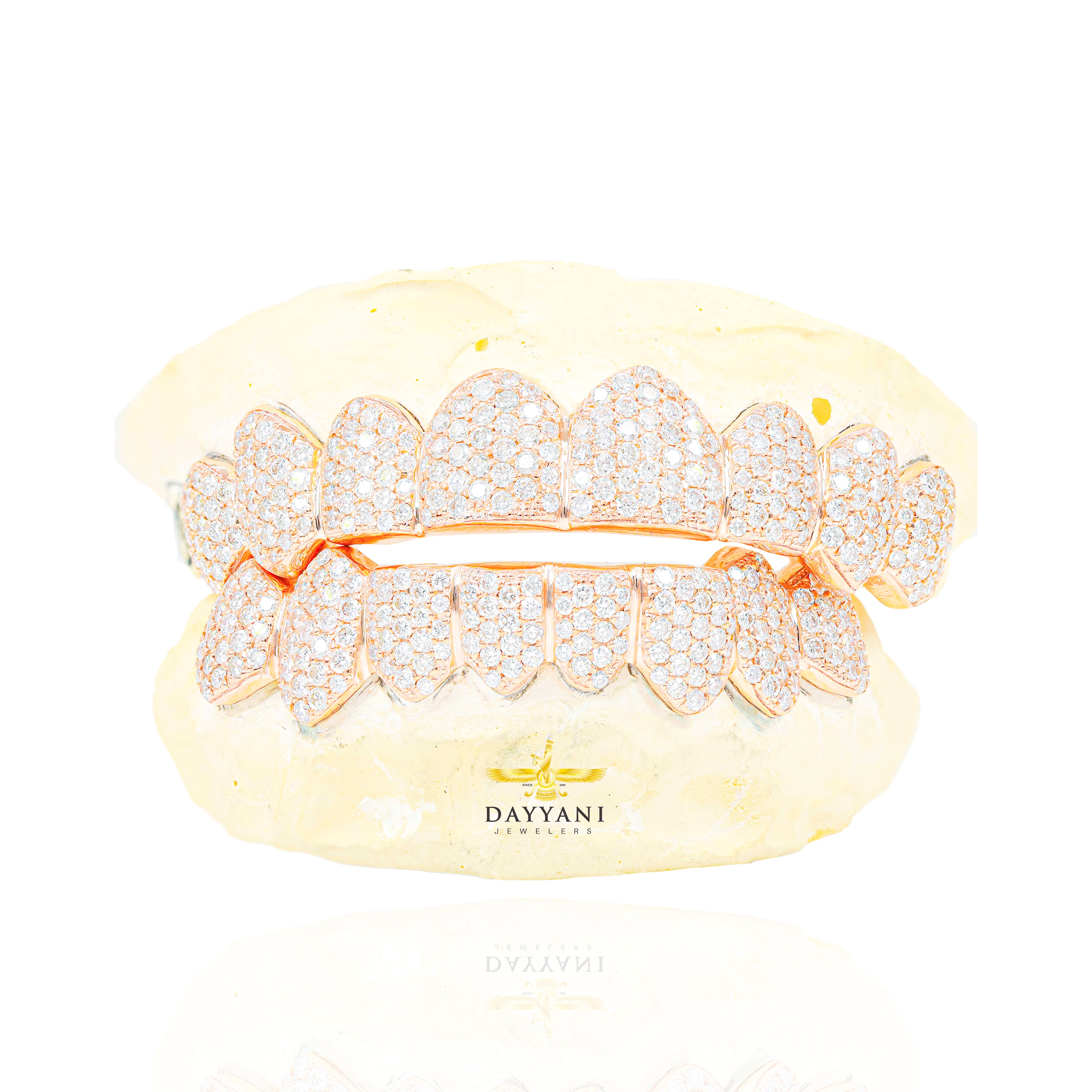 Custom SI Clarity Diamond Grillz Hand Set Natural Diamonds Gold Grillz (Zig-Zag Setting)