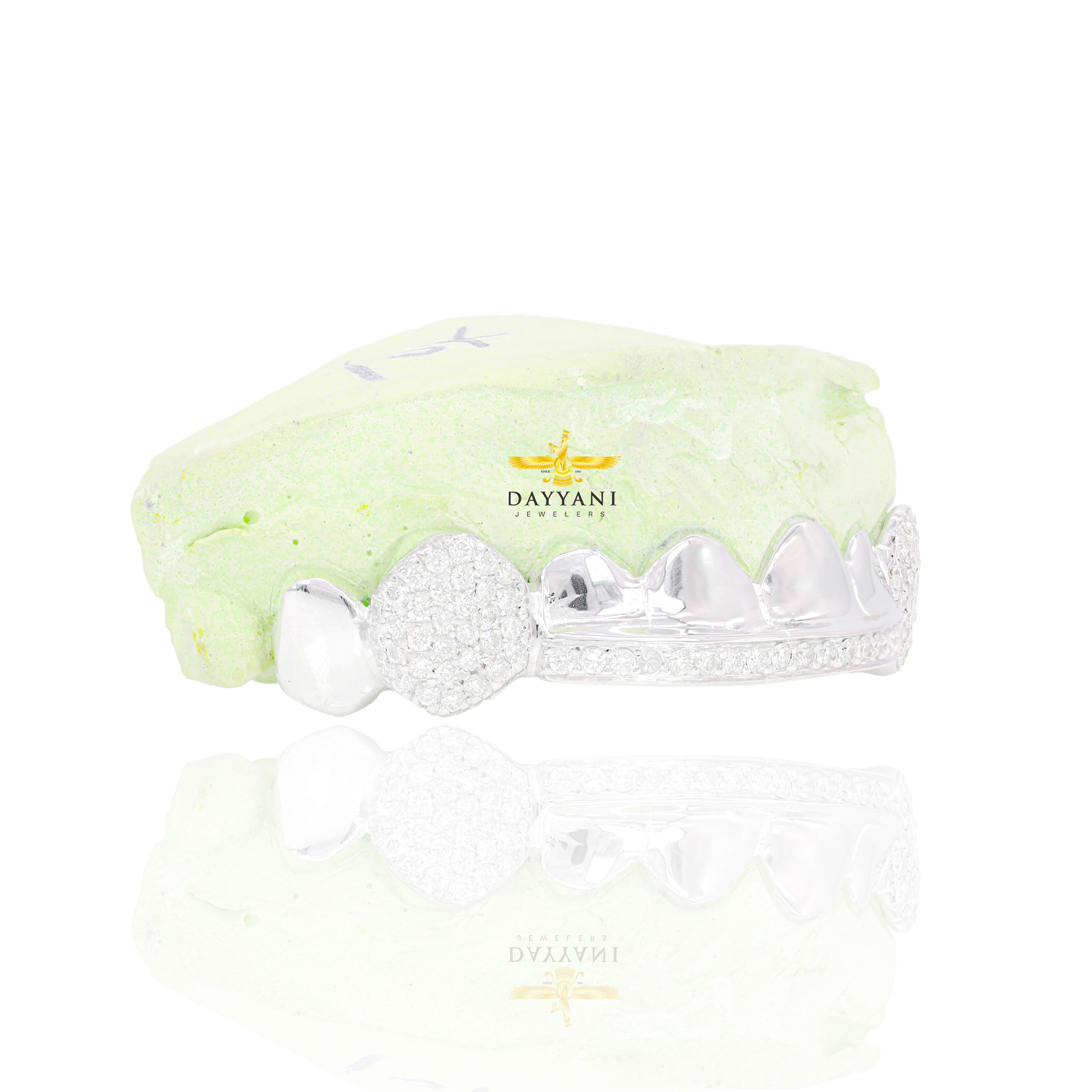 Custom 8 Teeth Grillz with Diamond on Fangs and Diamond Bar Gold Grillz