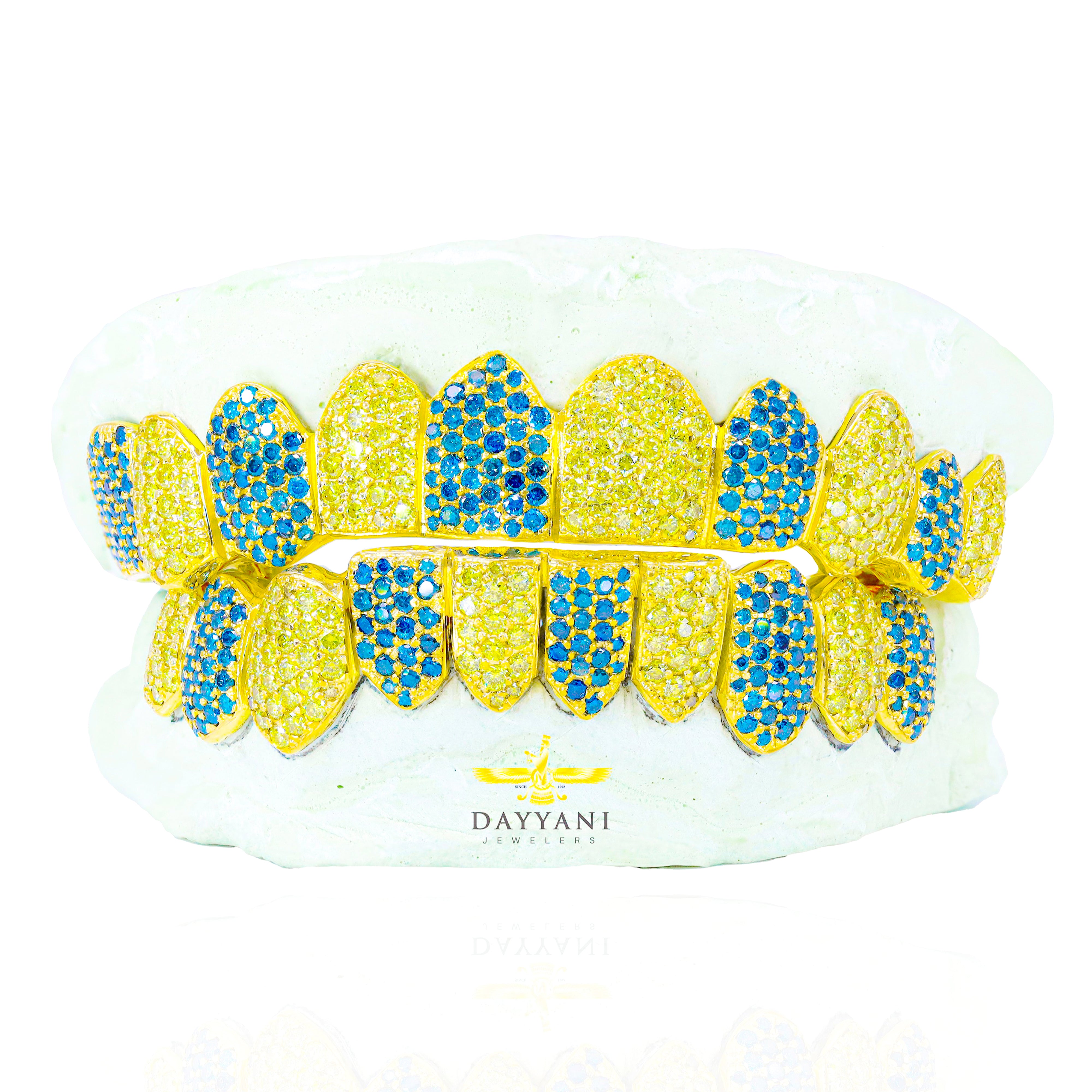 Custom Canary and Blue Hand Set Diamond Grillz Solid Gold Grillz (Zig-Zag Setting)