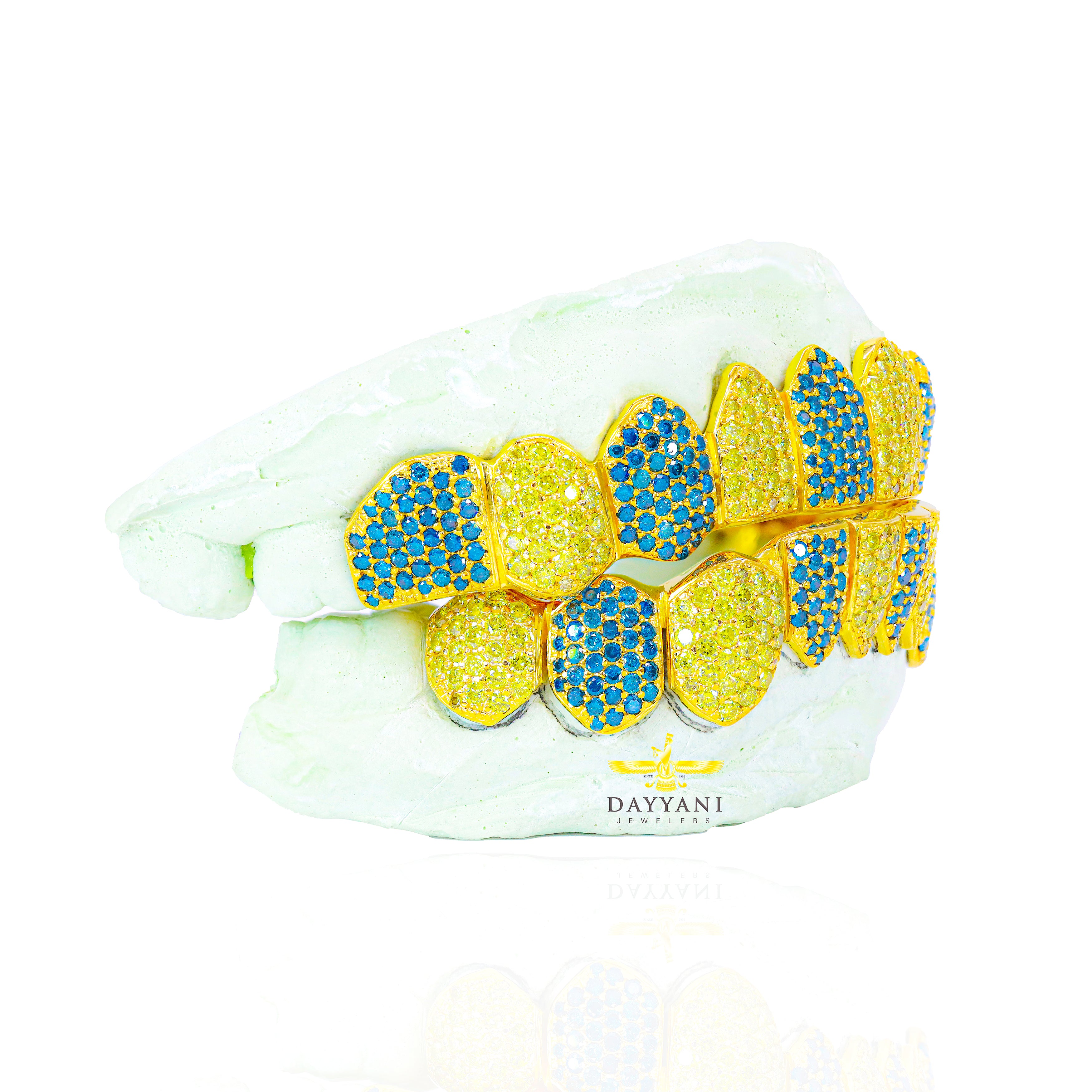 Custom Canary and Blue Hand Set Diamond Grillz Solid Gold Grillz (Zig-Zag Setting)