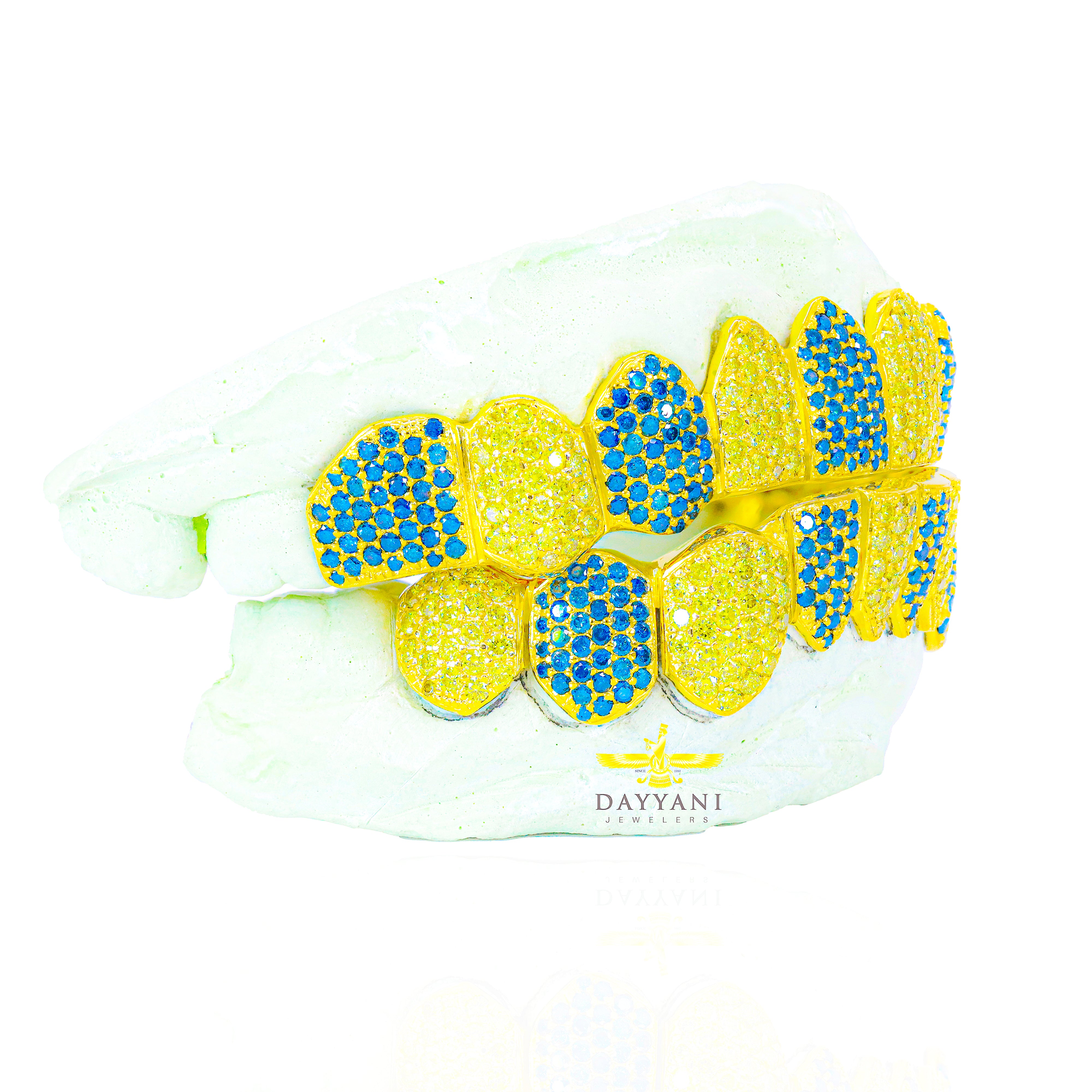 Custom Canary and Blue Hand Set Diamond Grillz Solid Gold Grillz (Zig-Zag Setting)