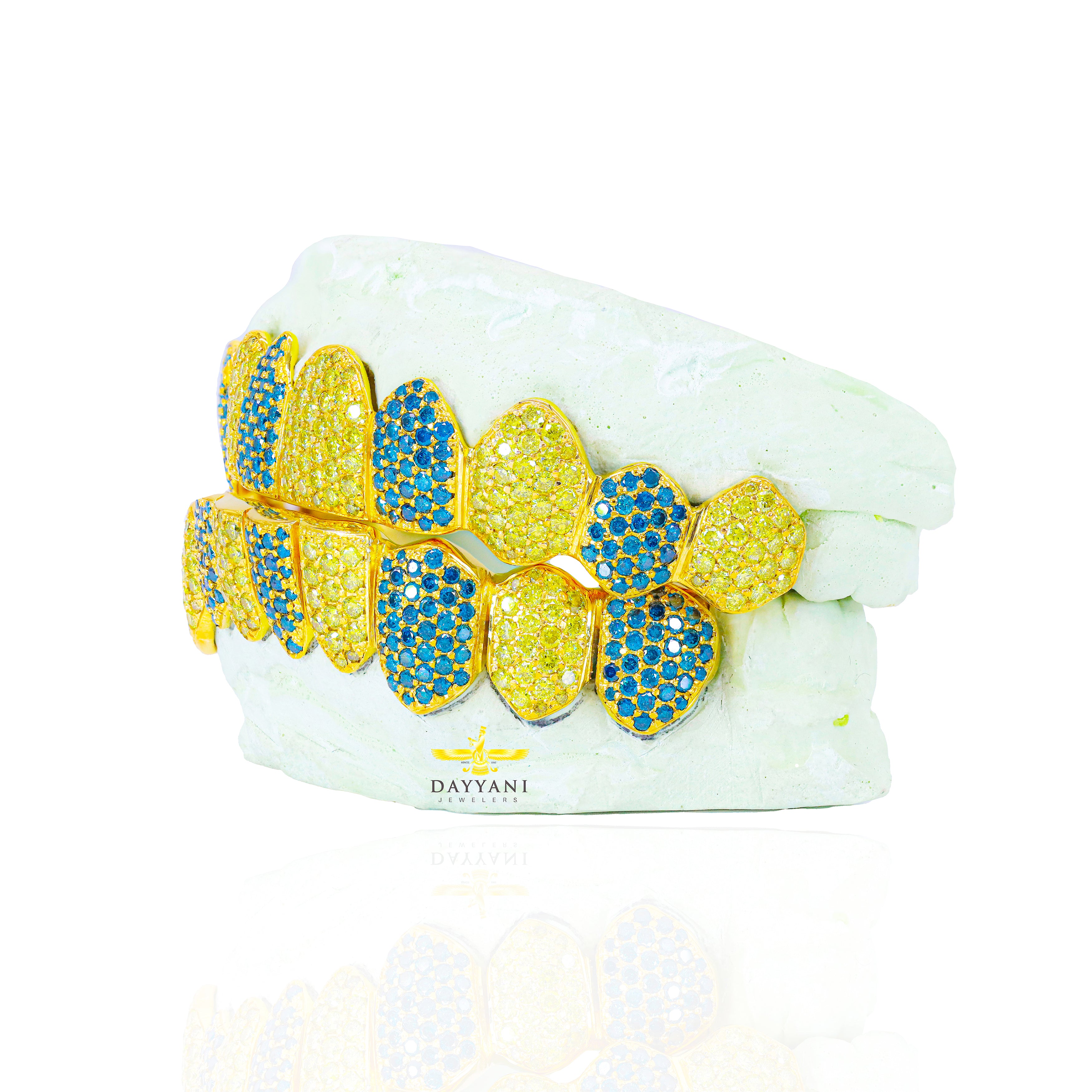 Custom Canary and Blue Hand Set Diamond Grillz Solid Gold Grillz (Zig-Zag Setting)