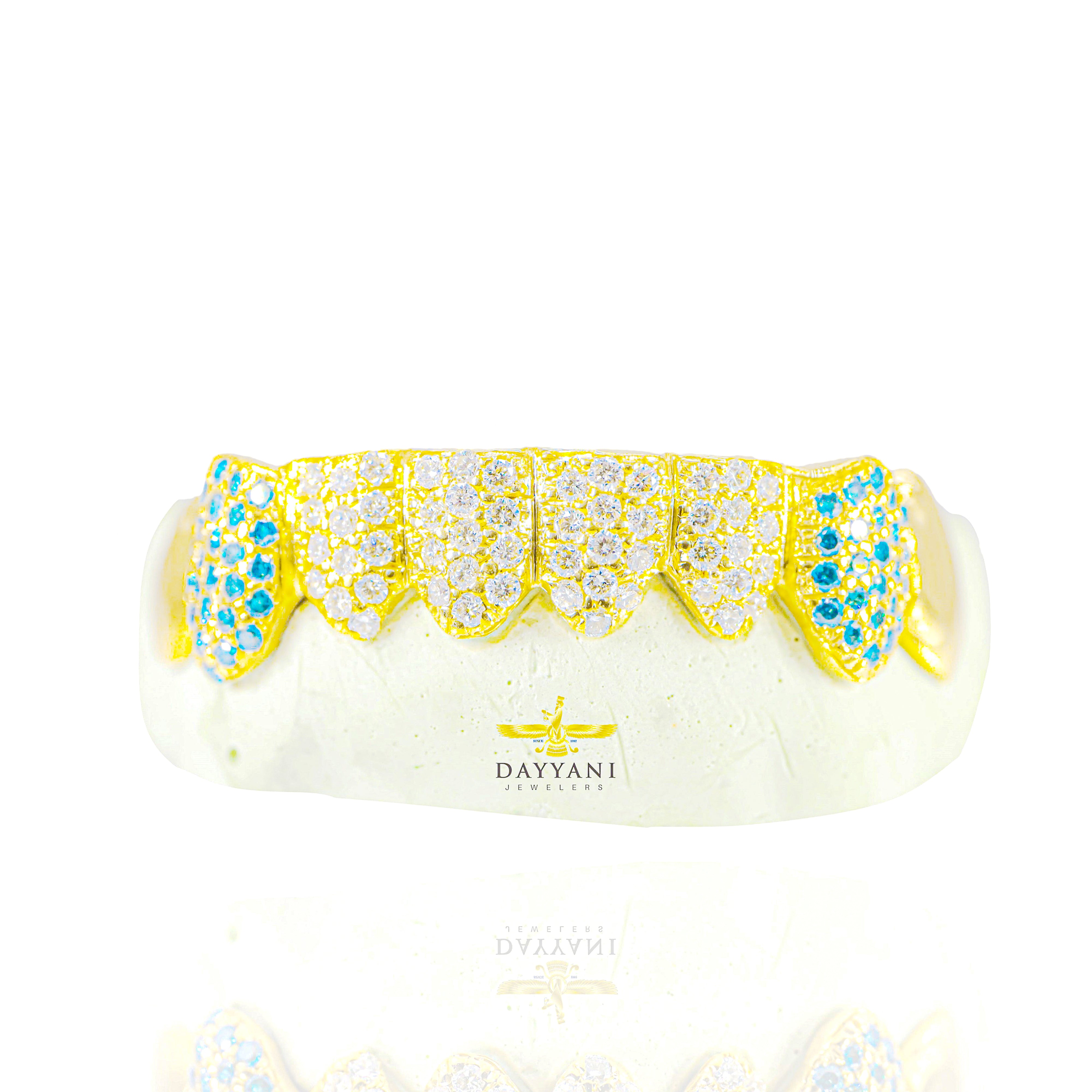 Custom Hand Set Natural White and Blue Diamonds Gold Grillz (Zig-Zag Setting)