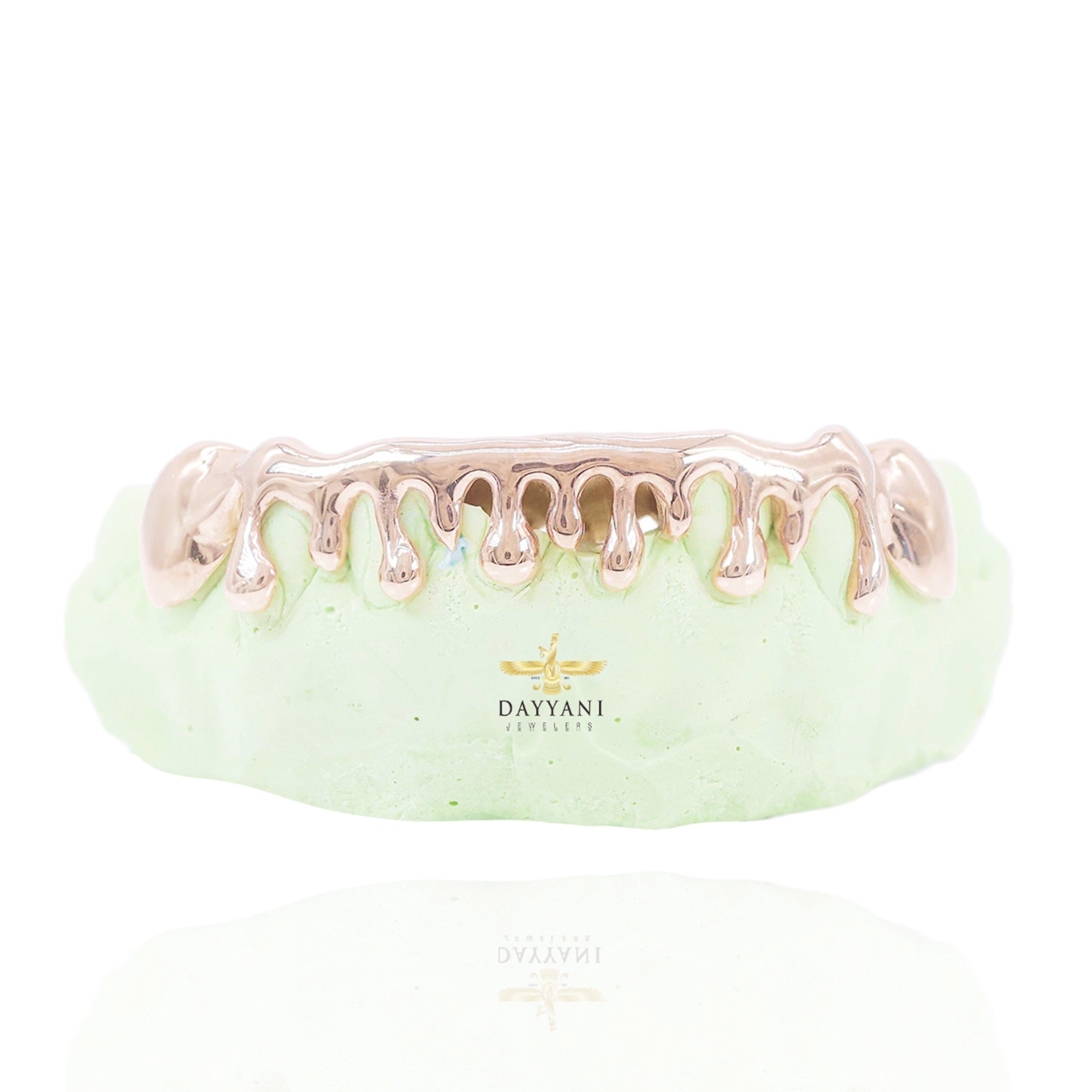 Custom Drip Style Gold Grillz