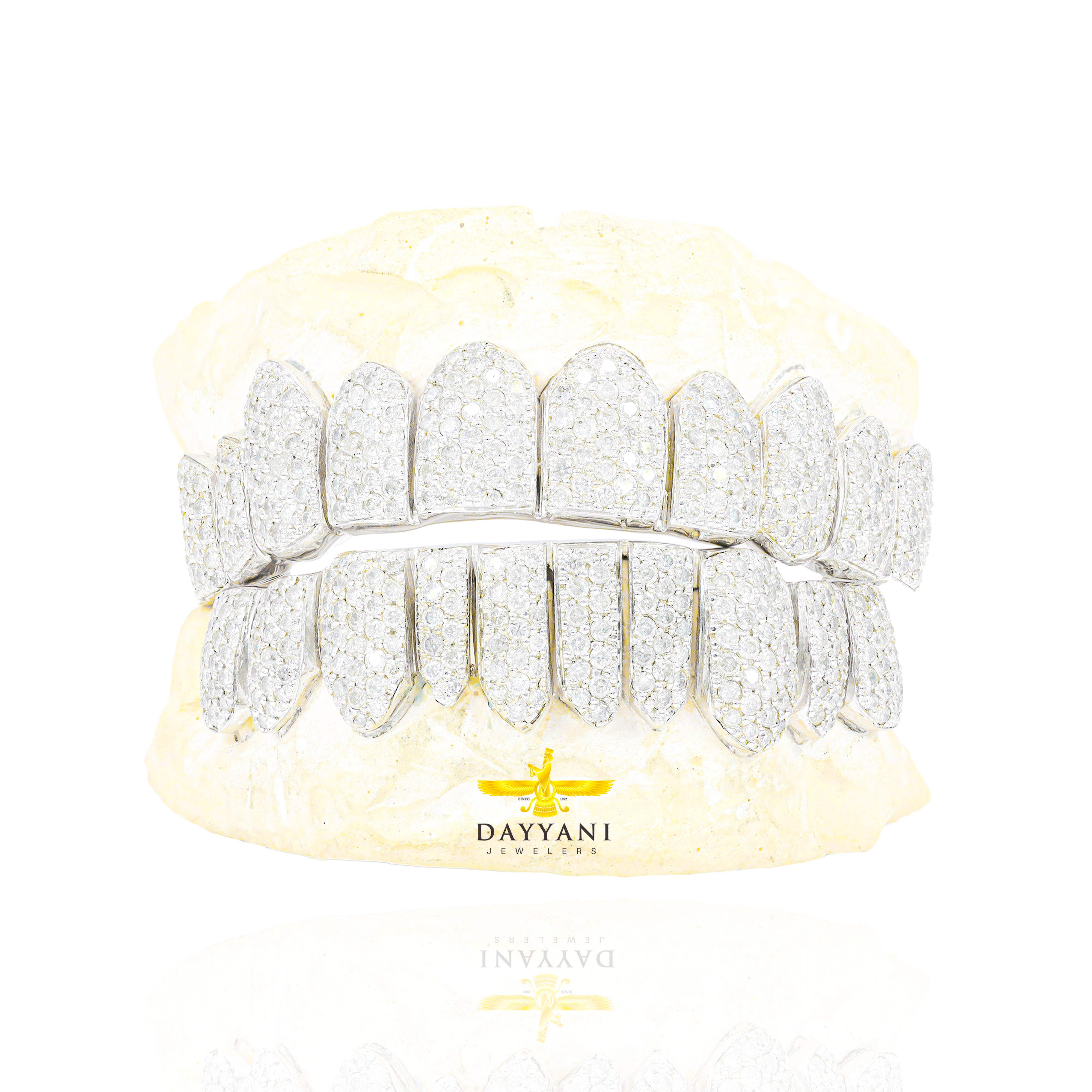 Custom I Clarity Diamond Grillz Hand Set Natural Diamonds Gold Grillz (Zig-Zag Setting)