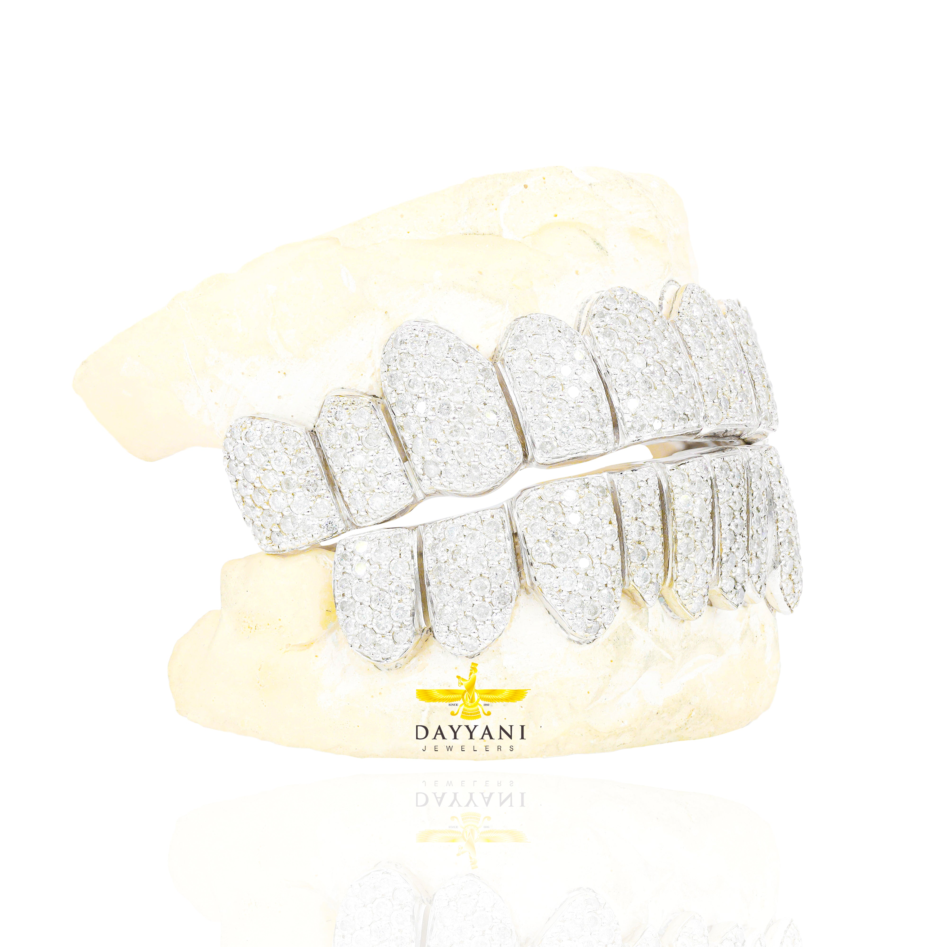 Custom I Clarity Diamond Grillz Hand Set Natural Diamonds Gold Grillz (Zig-Zag Setting)