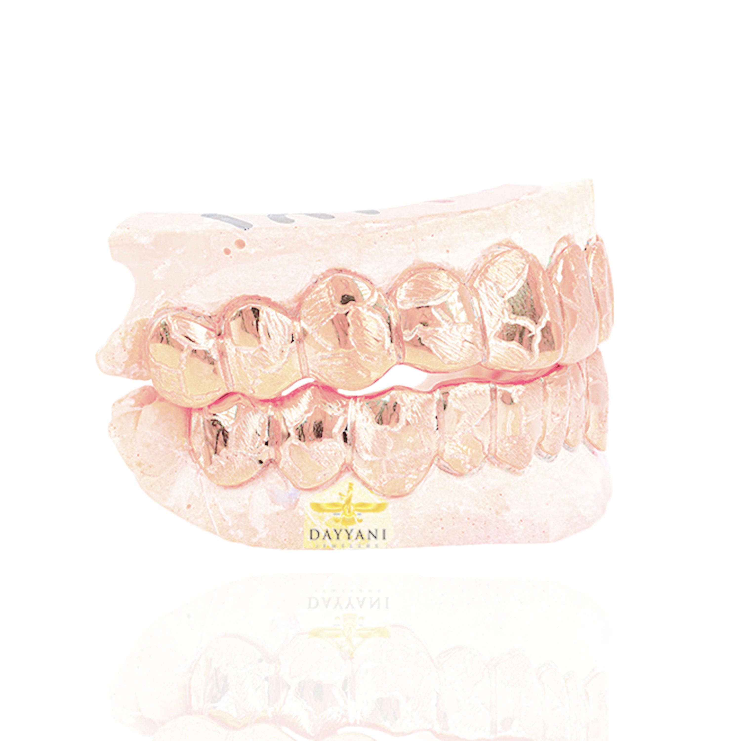 Custom Nugget Design Outline Gold Grillz