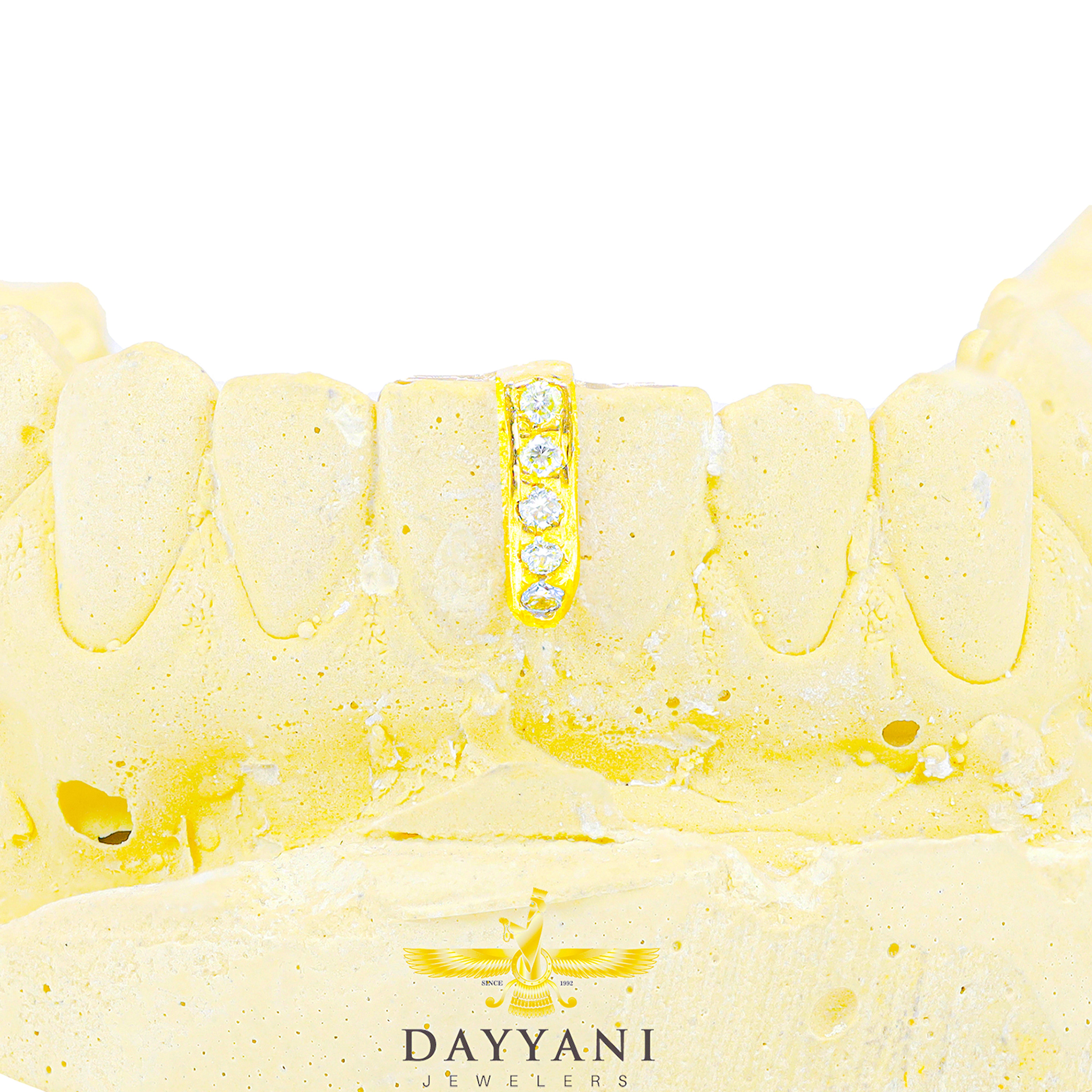 Custom Gold Gap Filler with Diamonds Grillz