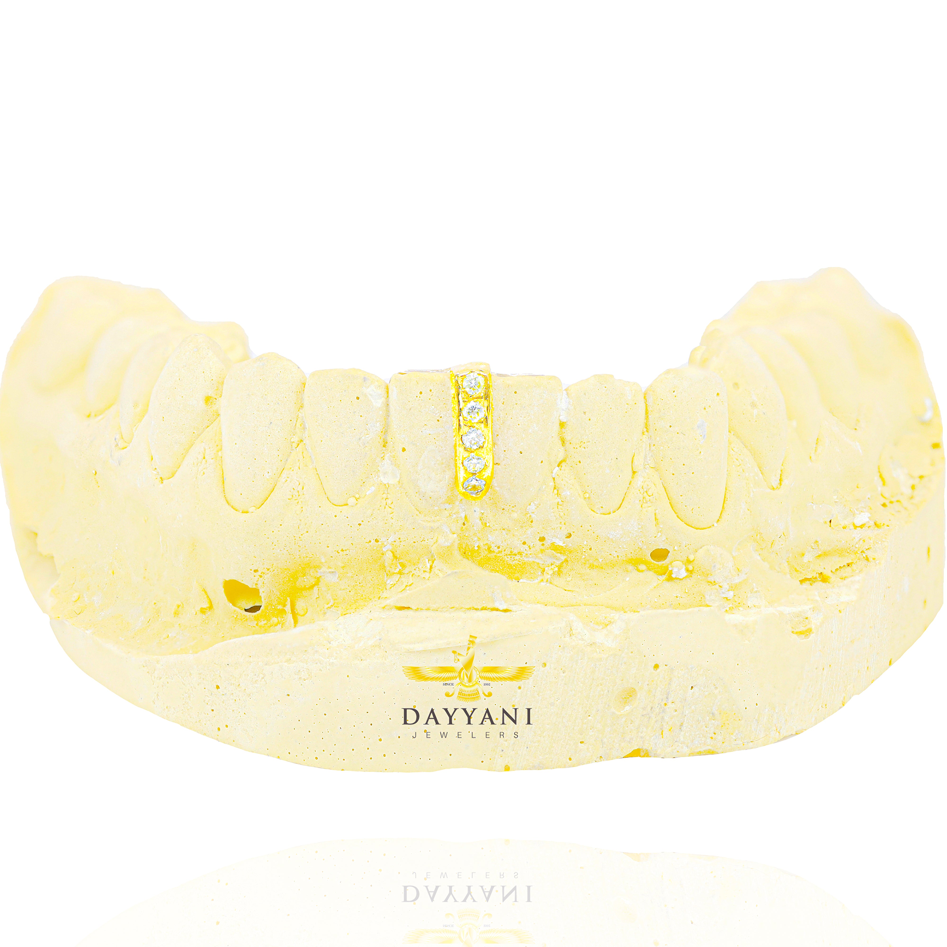 Custom Gold Gap Filler with Diamonds Grillz