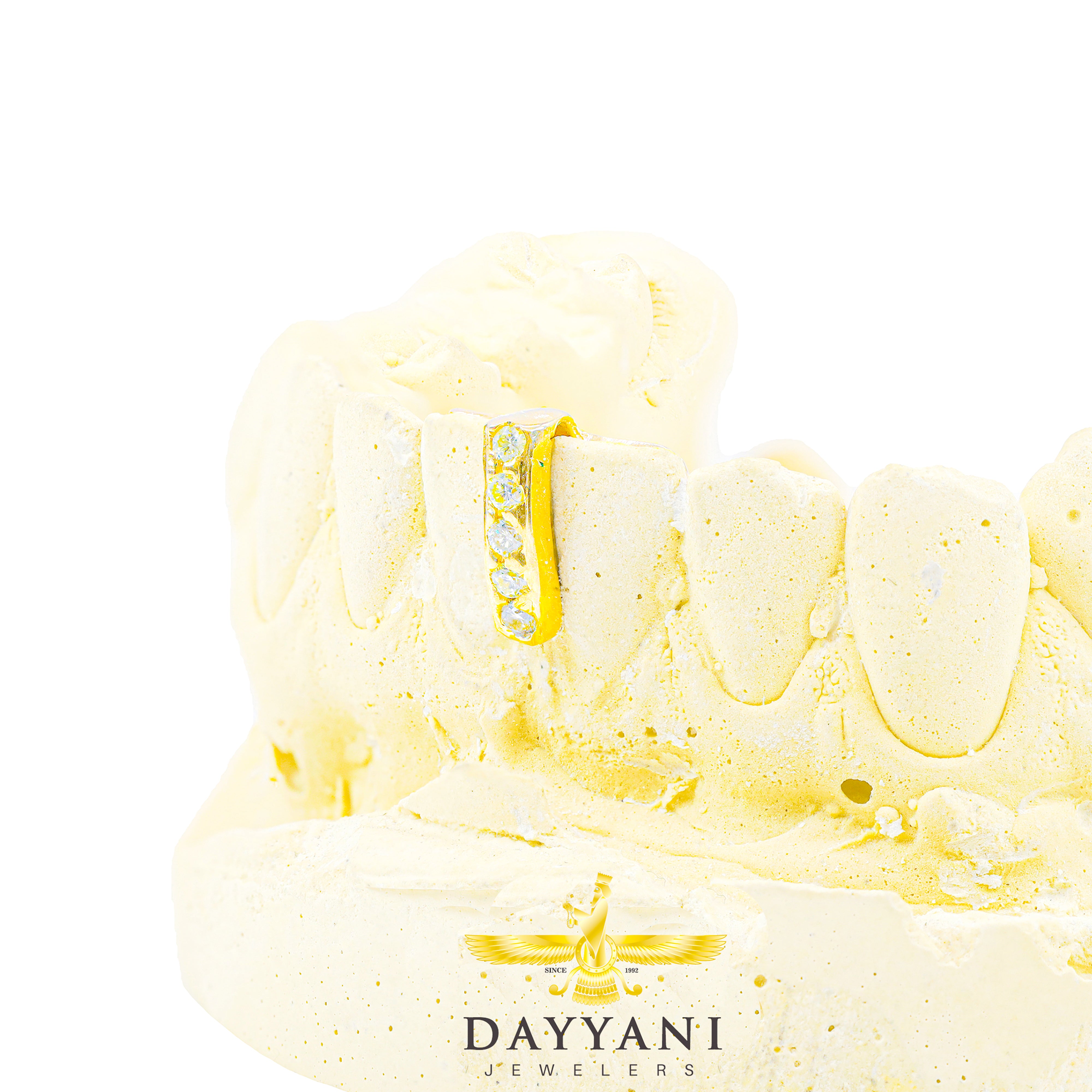 Custom Gold Gap Filler with Diamonds Grillz