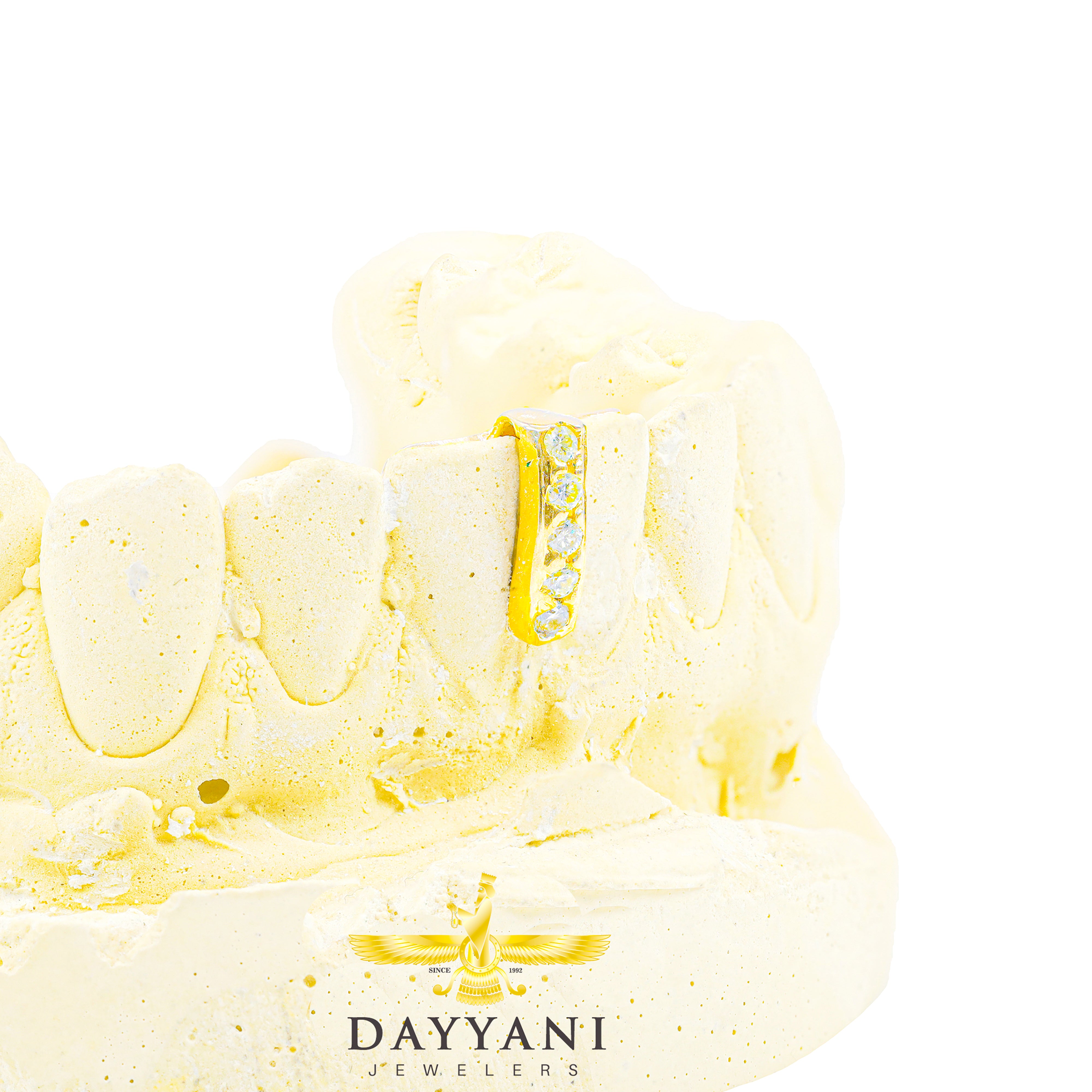 Custom Gold Gap Filler with Diamonds Grillz