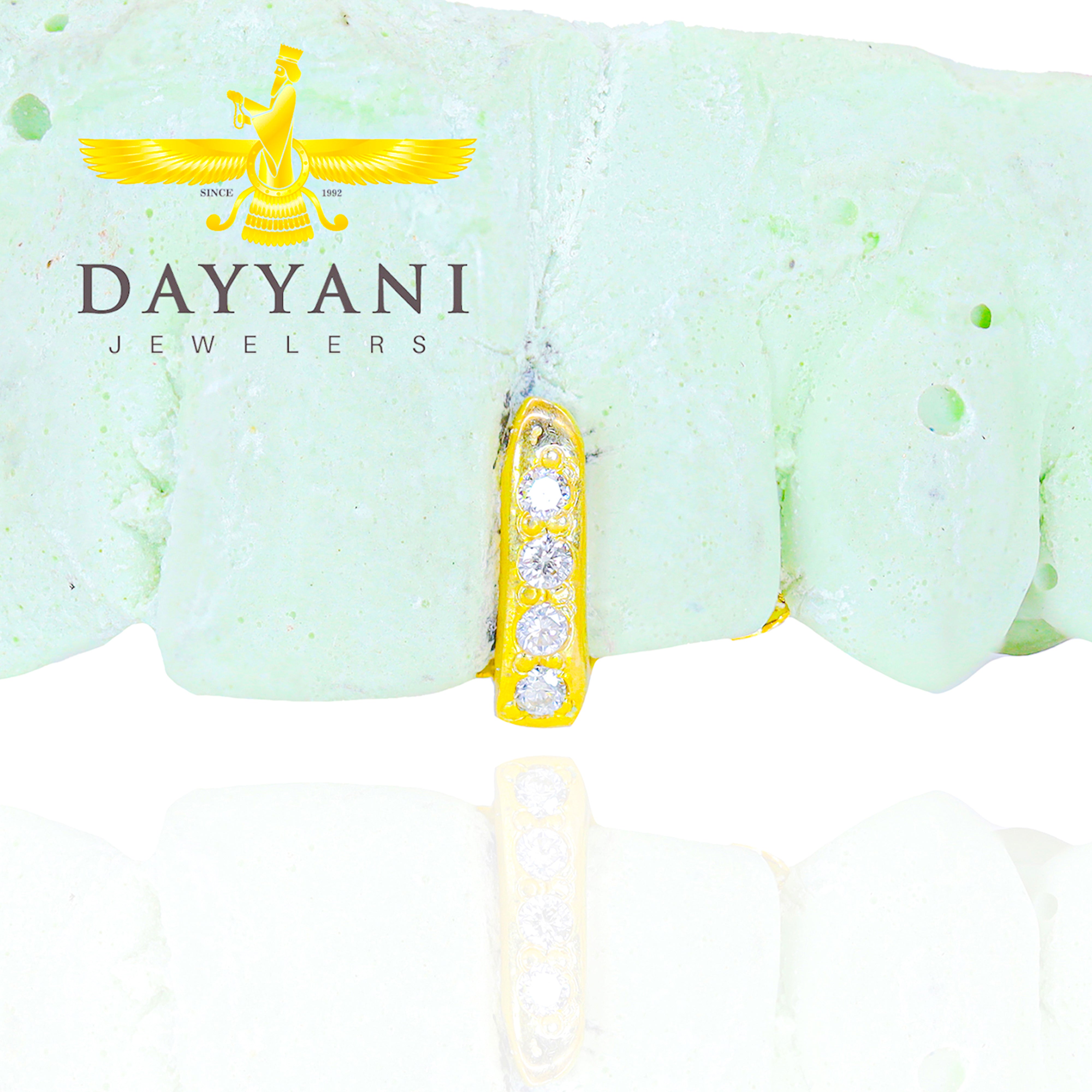 Custom Gold Gap Filler with Diamonds Grillz
