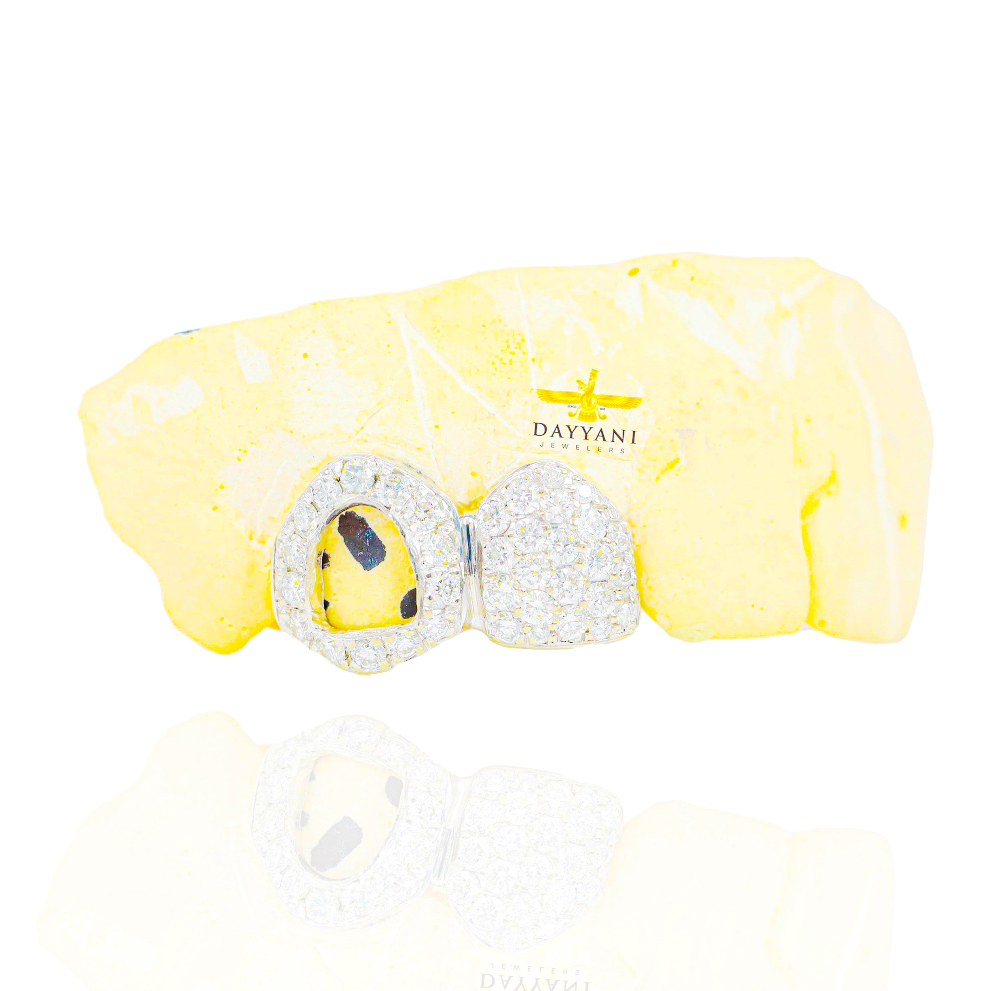 Custom ANY 2 Teeth Diamond One Open Face (Connected) Gold Grillz