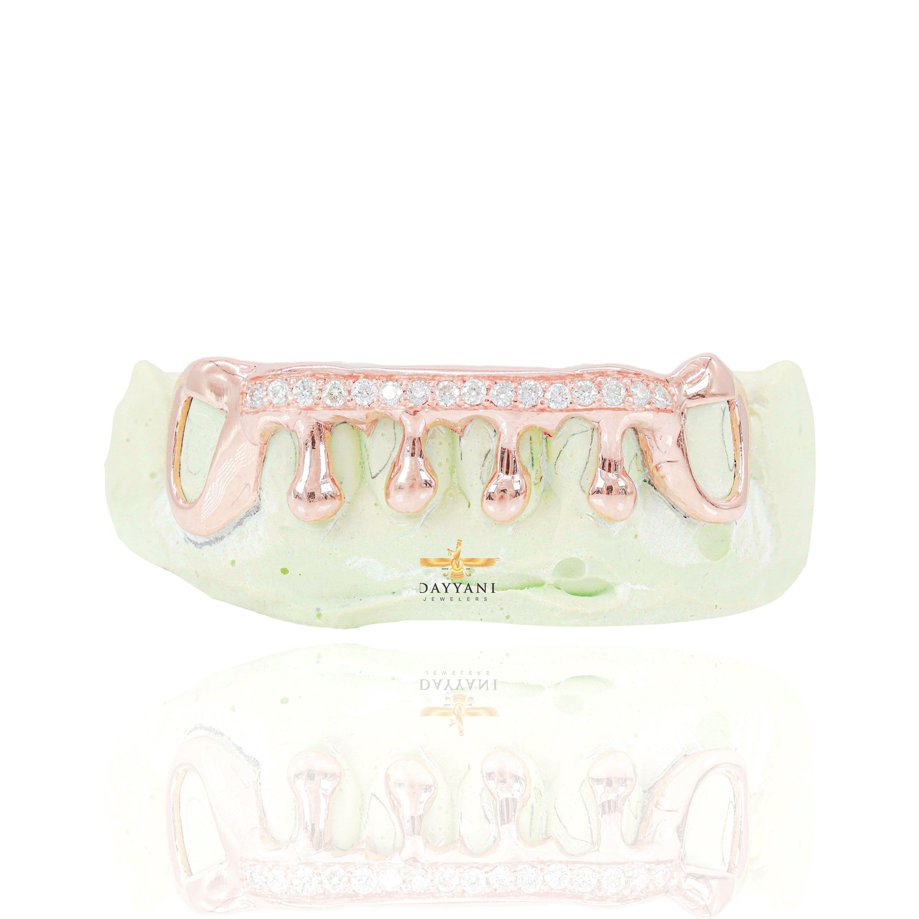Custom One Row Diamond Bar with Solid Gold Drip Grillz