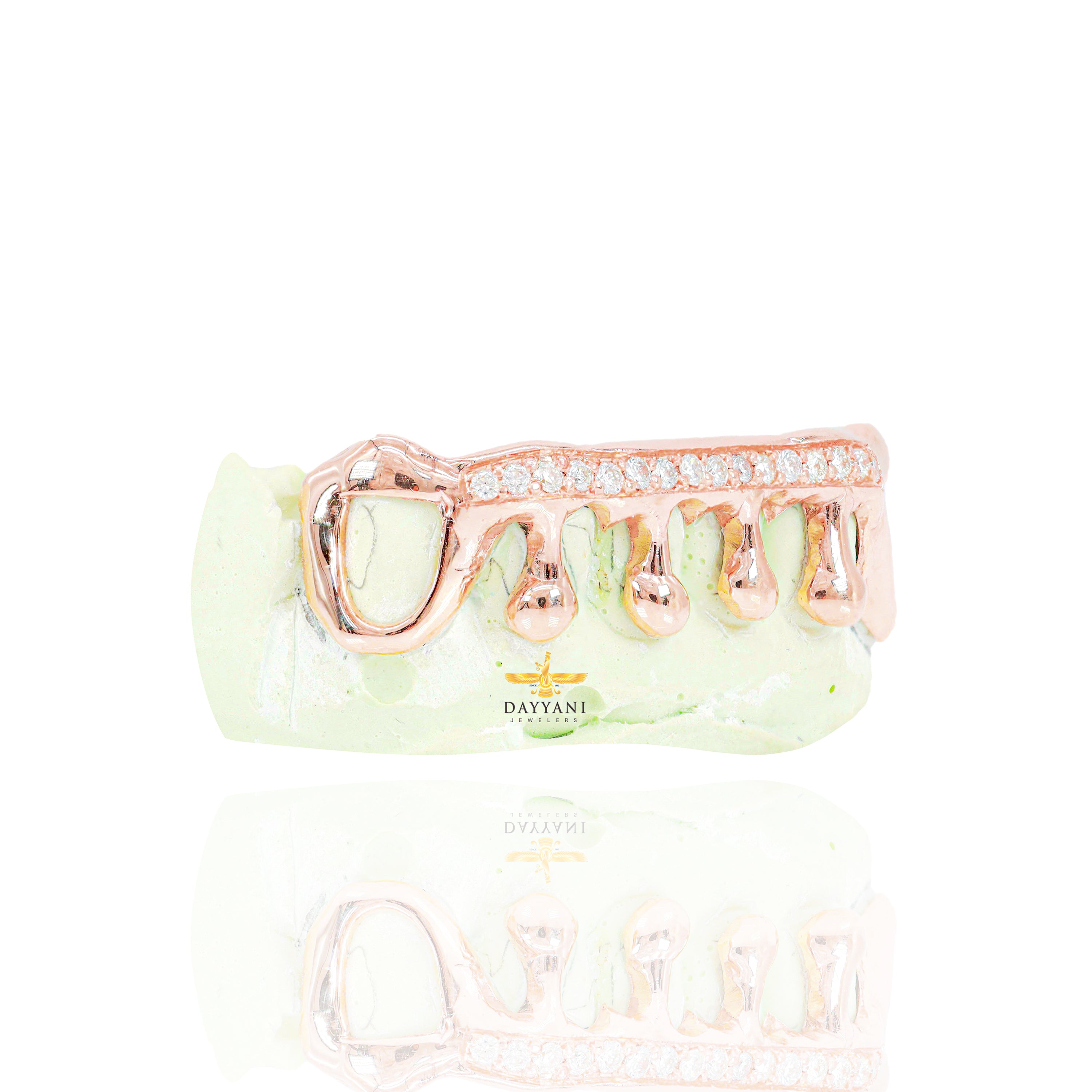 Custom One Row Diamond Bar with Solid Gold Drip Grillz