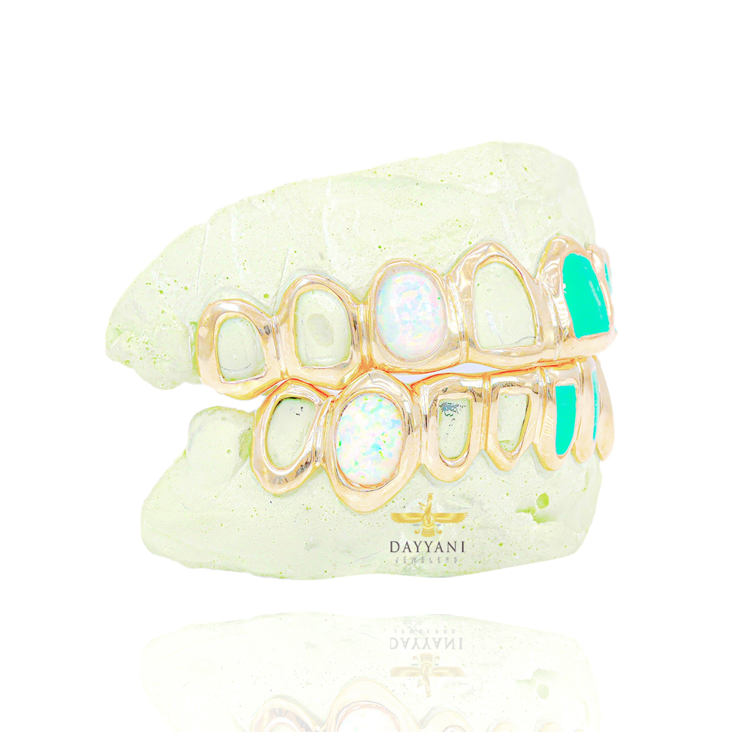 OFFICIAL Custom 8 on 8 FAT NWIGWE 'Mint Condition' Gold Grillz