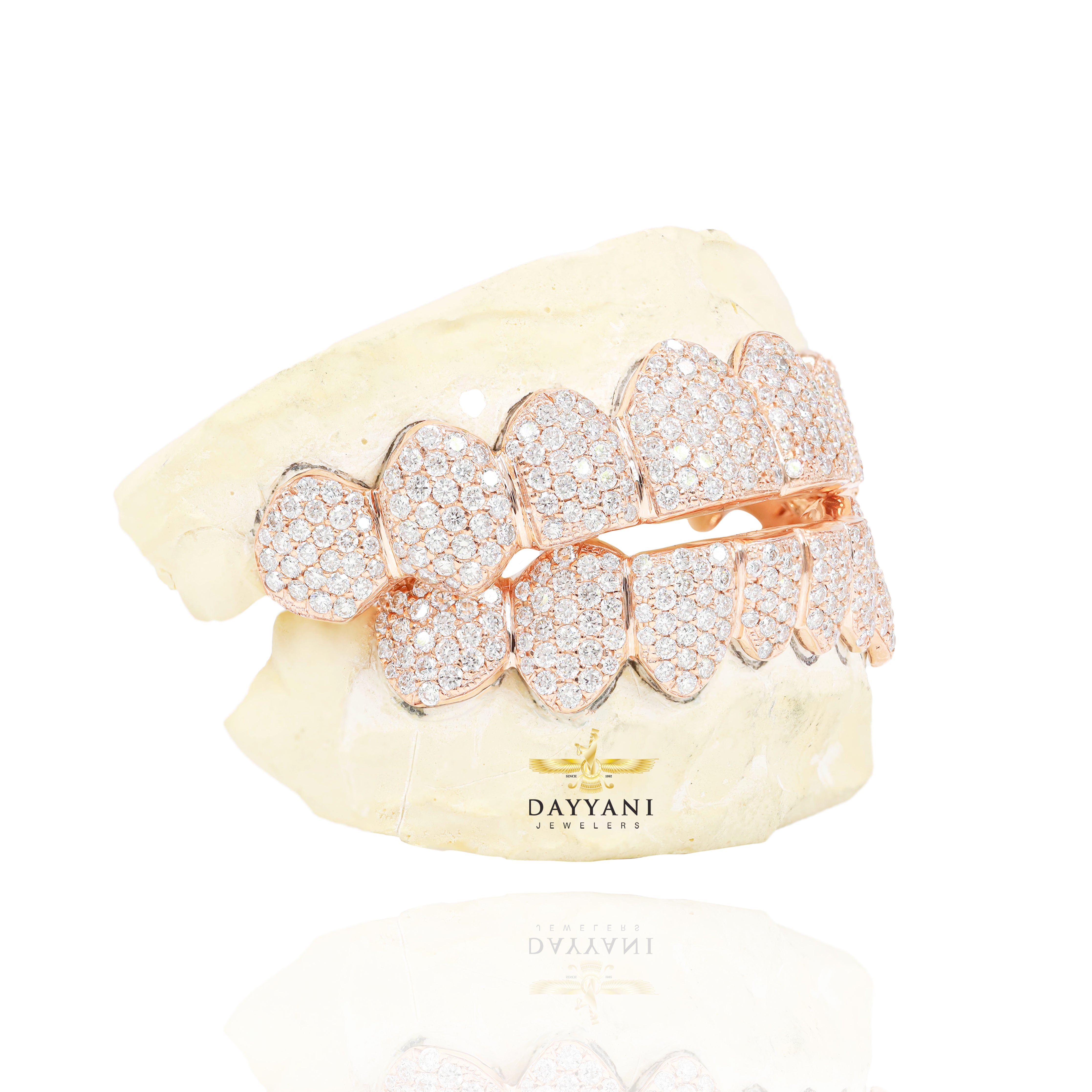 Custom SI Clarity Diamond Grillz Hand Set Natural Diamonds Gold Grillz (Zig-Zag Setting)