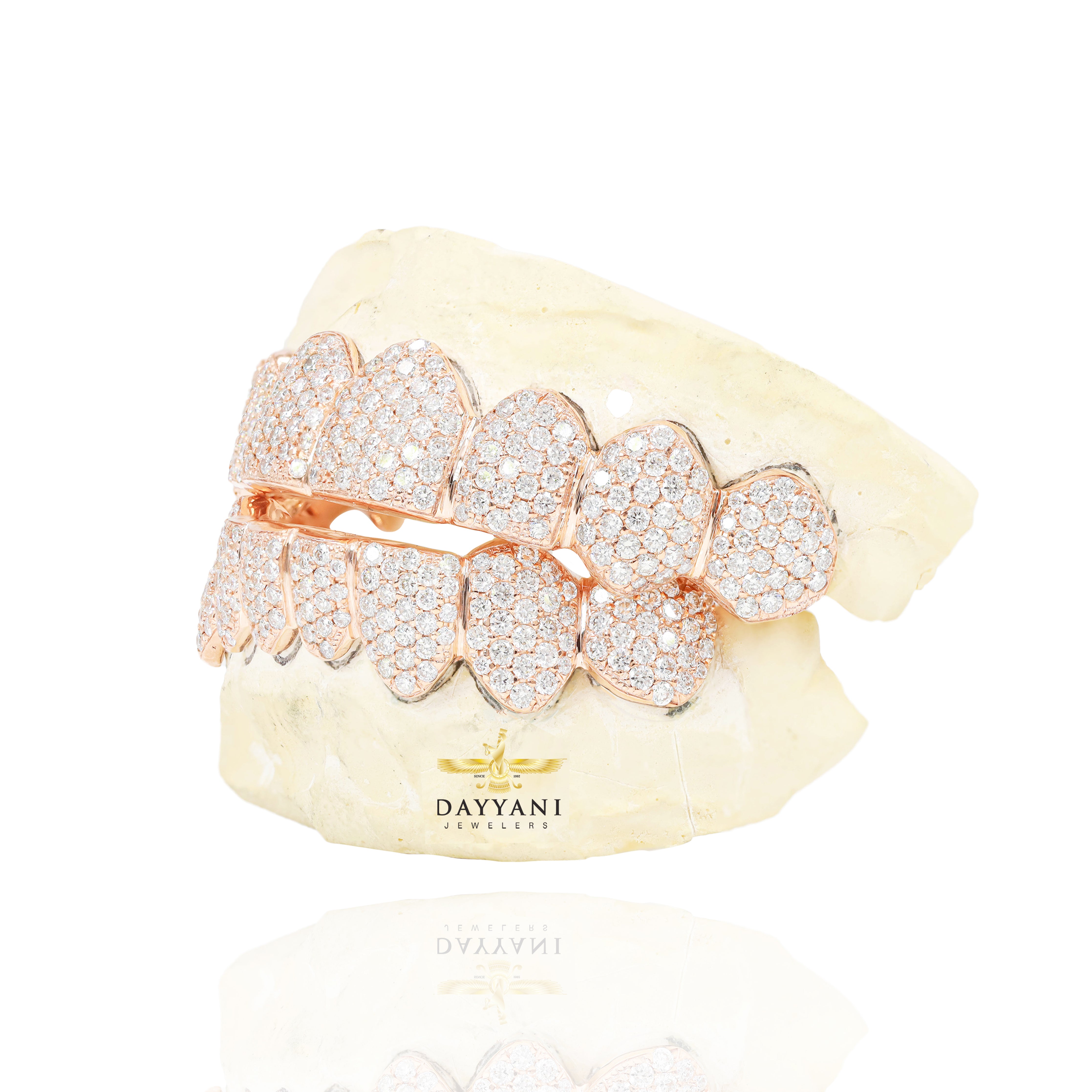 Custom SI Clarity Diamond Grillz Hand Set Natural Diamonds Gold Grillz (Zig-Zag Setting)
