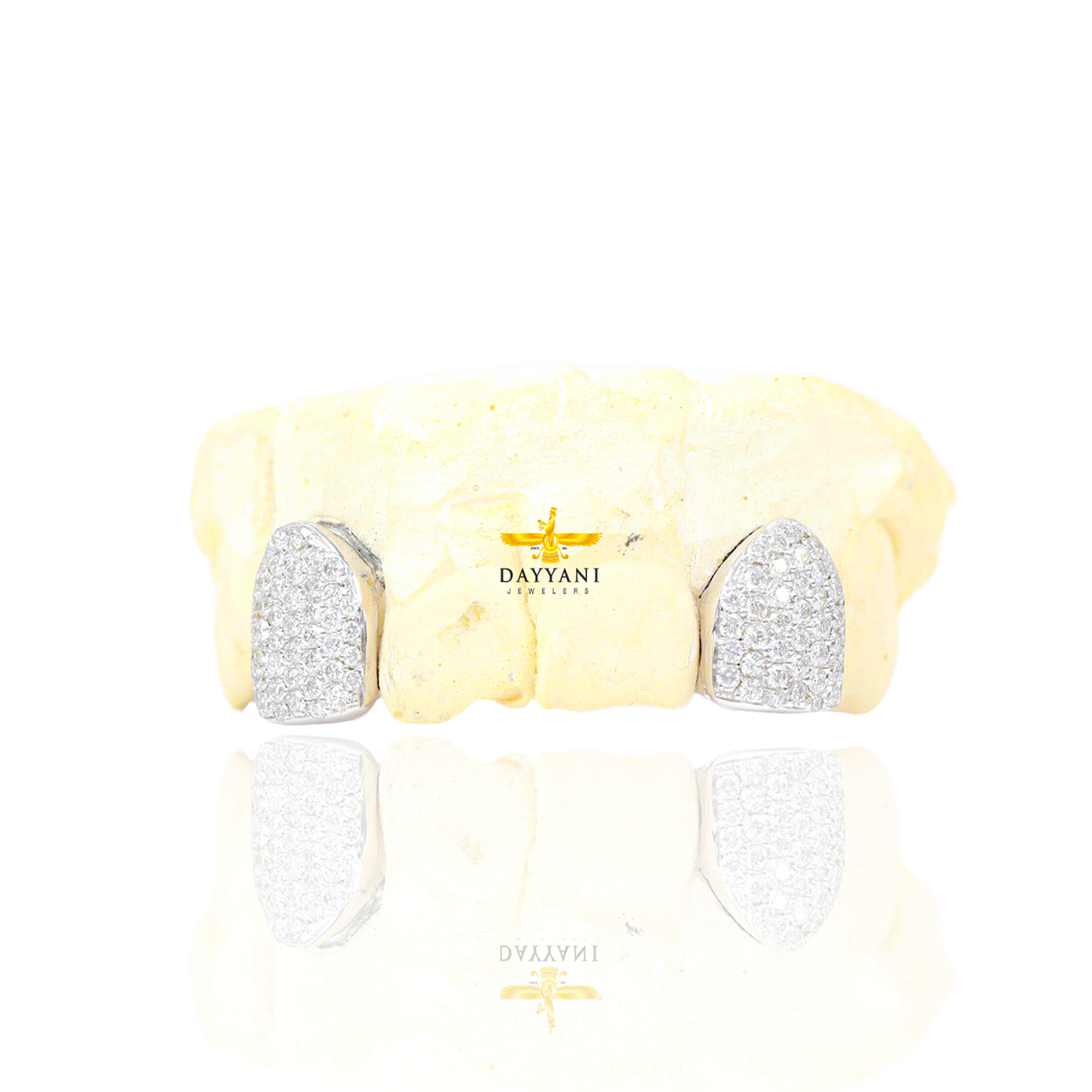 Custom 2 Teeth Incisors Diamond Grillz with Back Bar