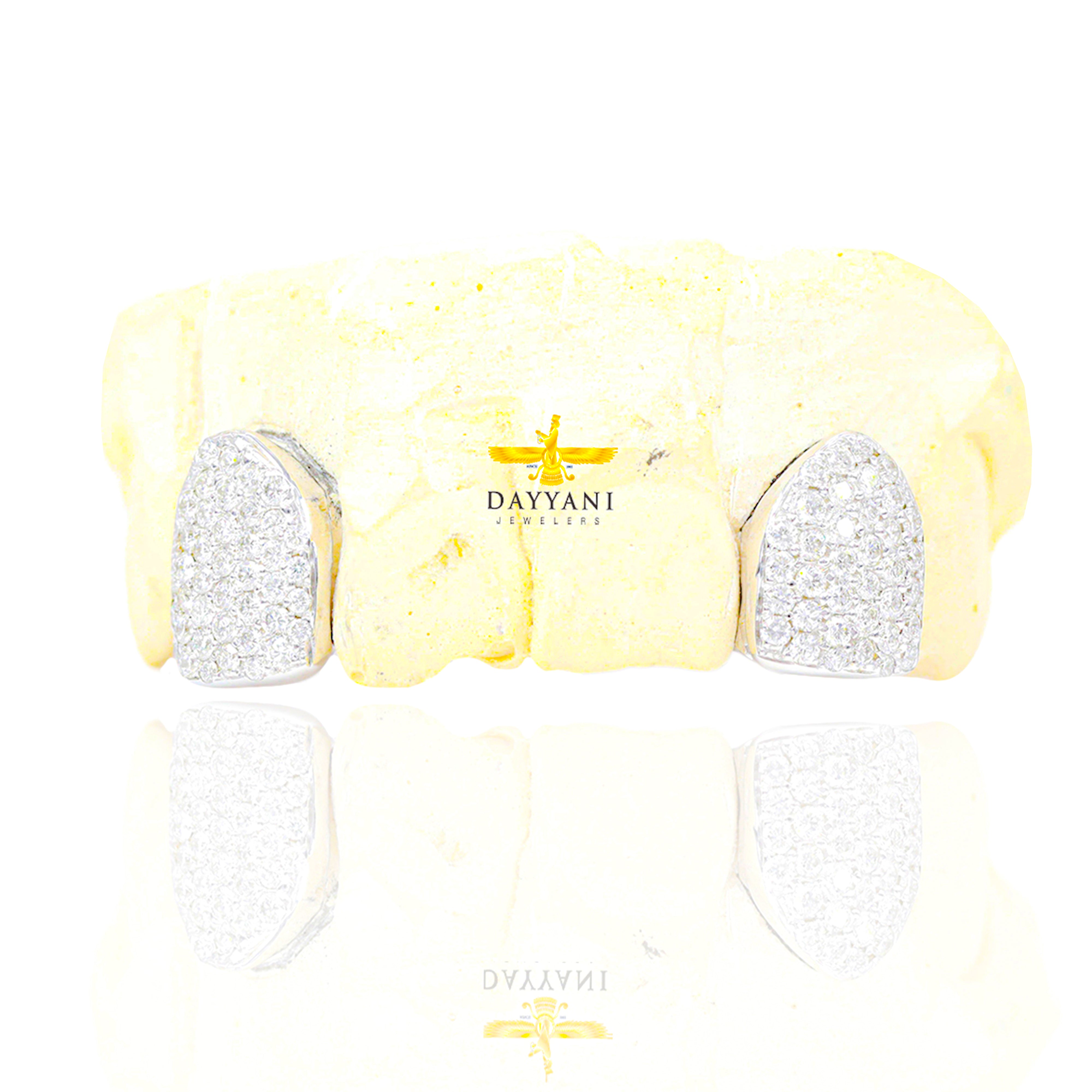 Custom 2 Teeth Incisors Diamond Grillz with Back Bar