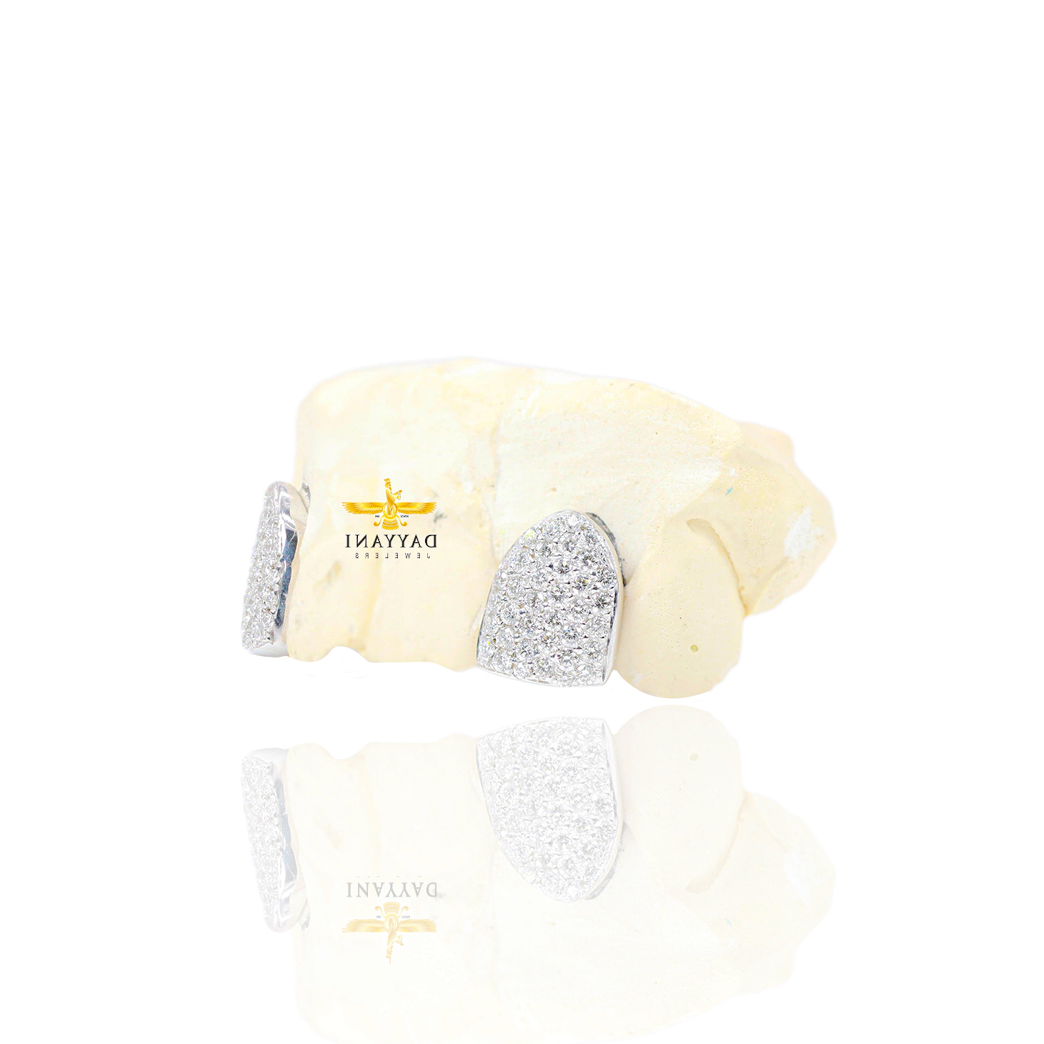 Custom 2 Teeth Incisors Diamond Grillz with Back Bar