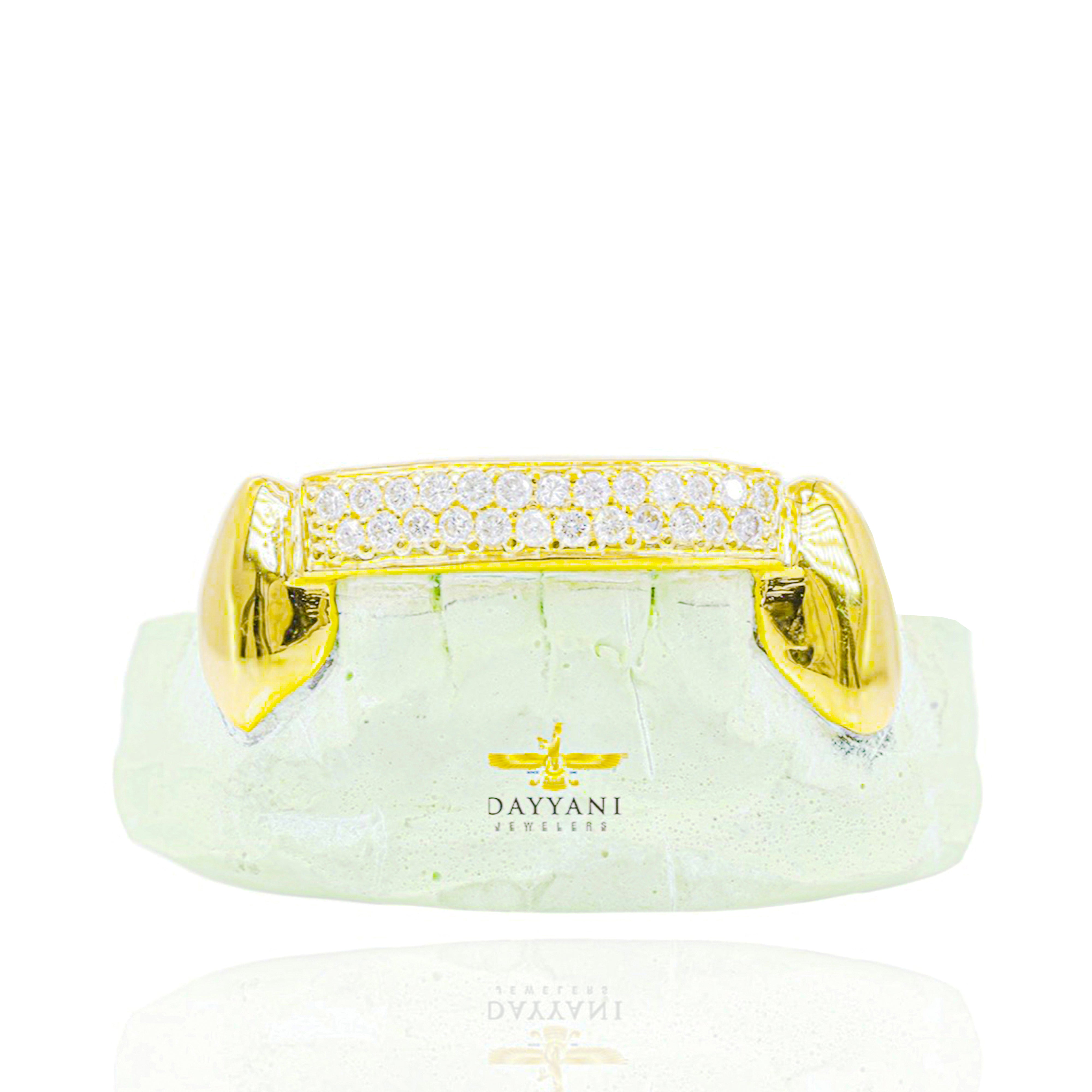 Custom Two Row Diamond Bar Gold Grillz