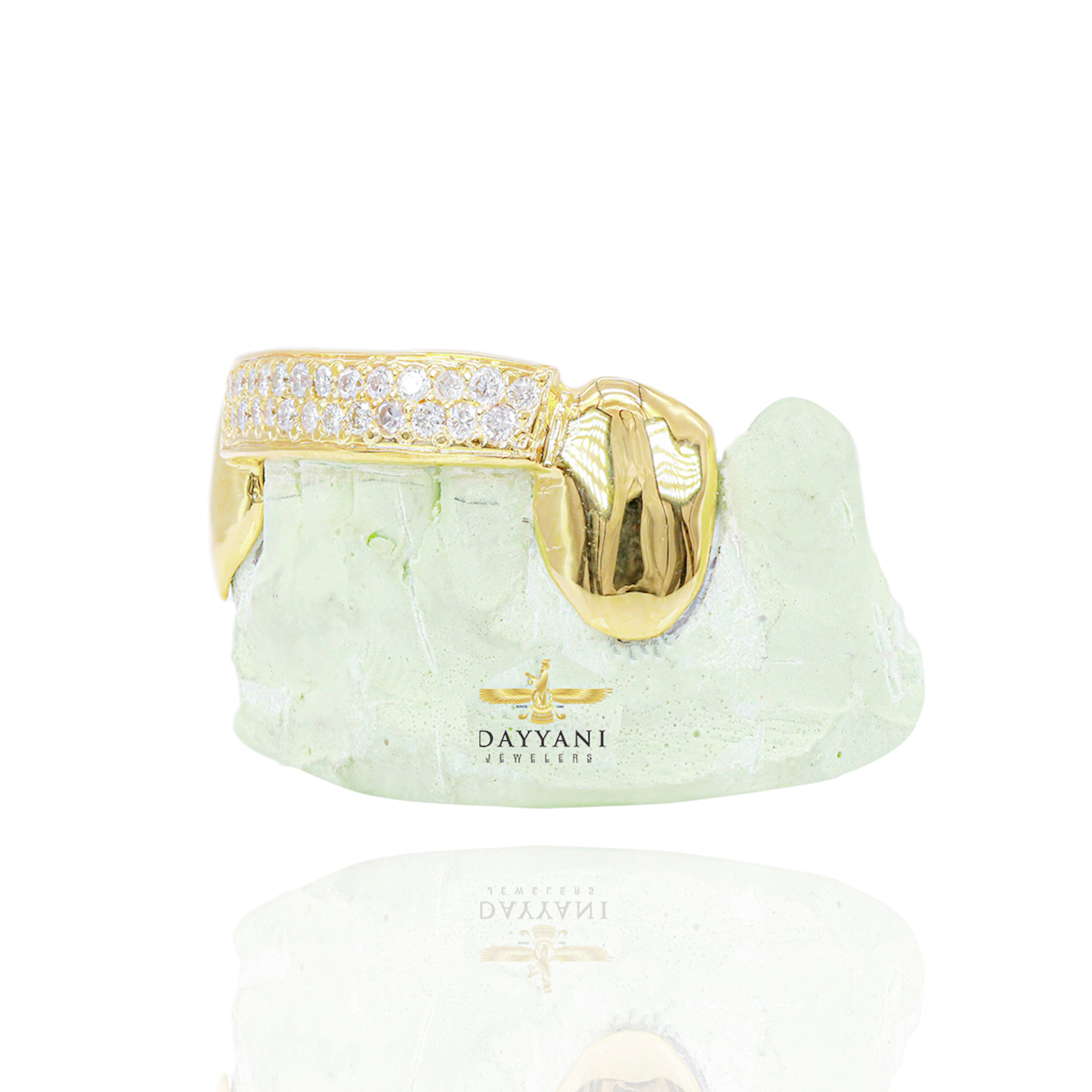 Custom Two Row Diamond Bar Gold Grillz