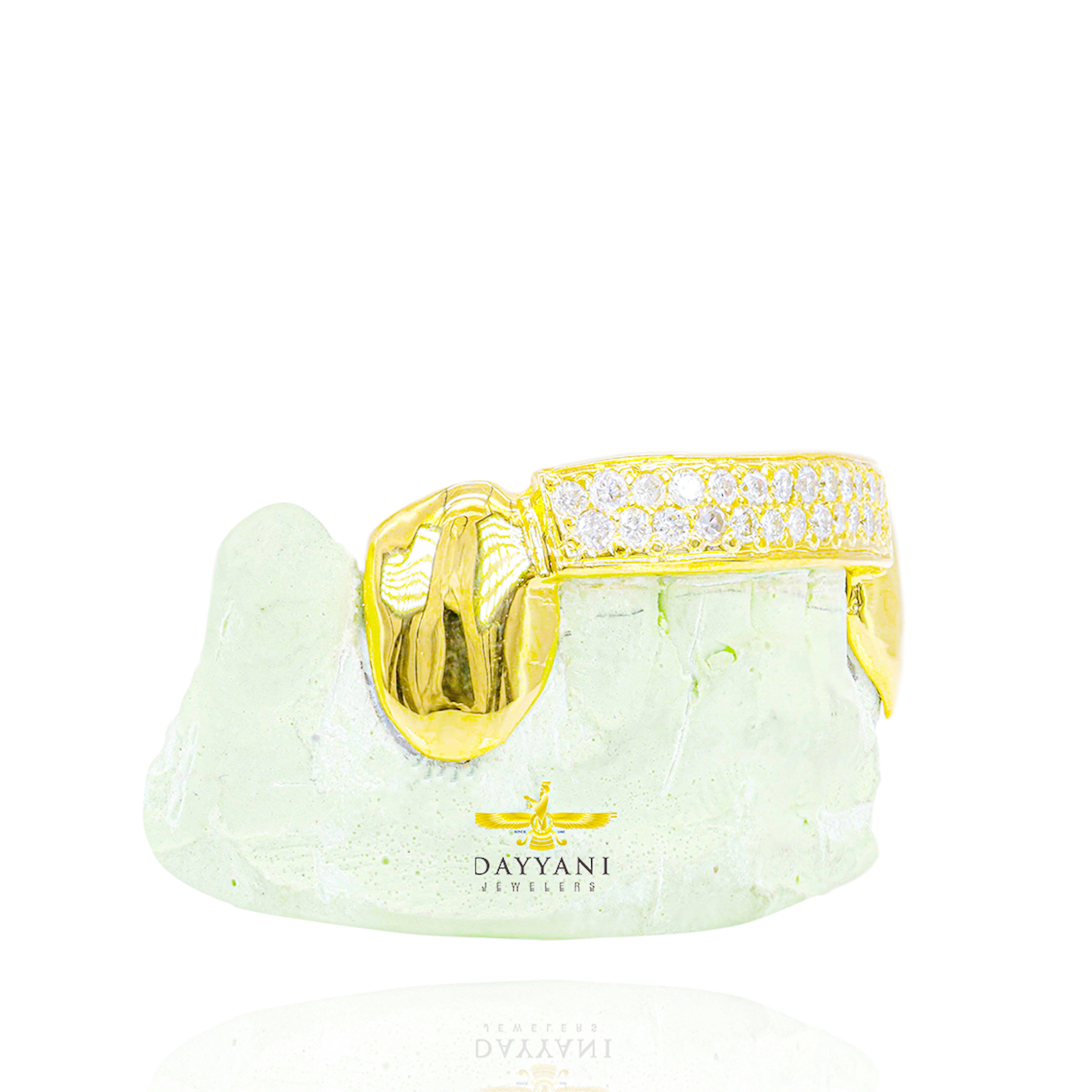 Custom Two Row Diamond Bar Gold Grillz