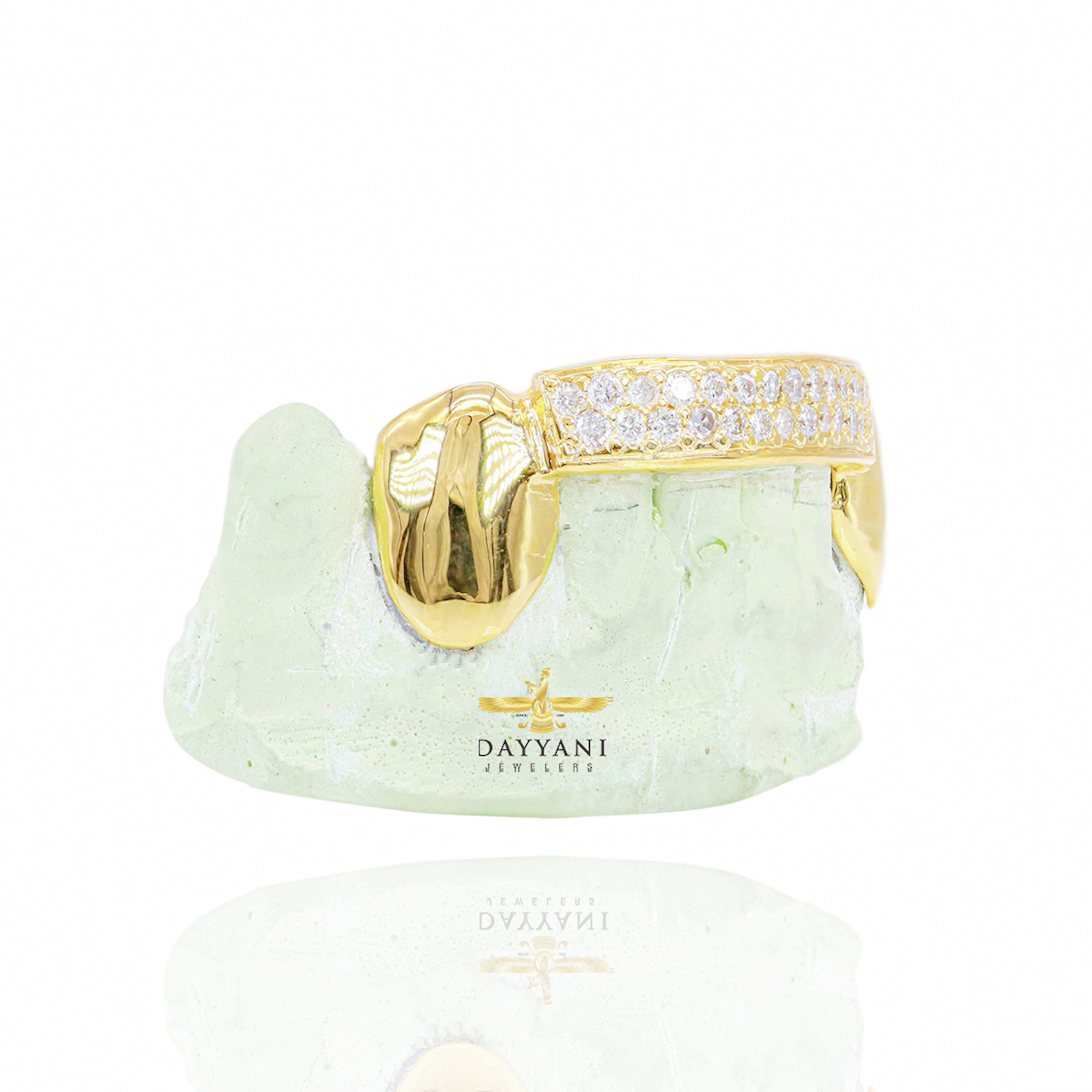 Custom Two Row Diamond Bar Gold Grillz