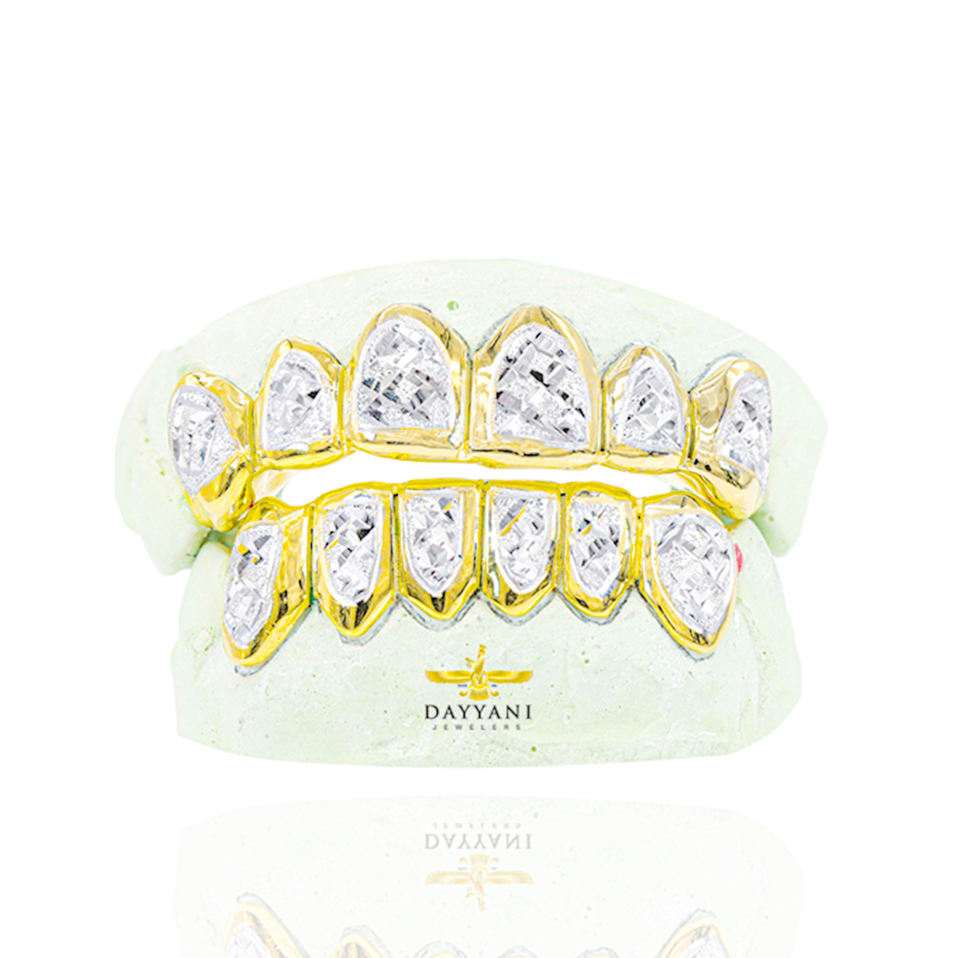 Custom Two-Tone Diamond Cut & Diamond Dust w/ Solid Trim Gold Grillz