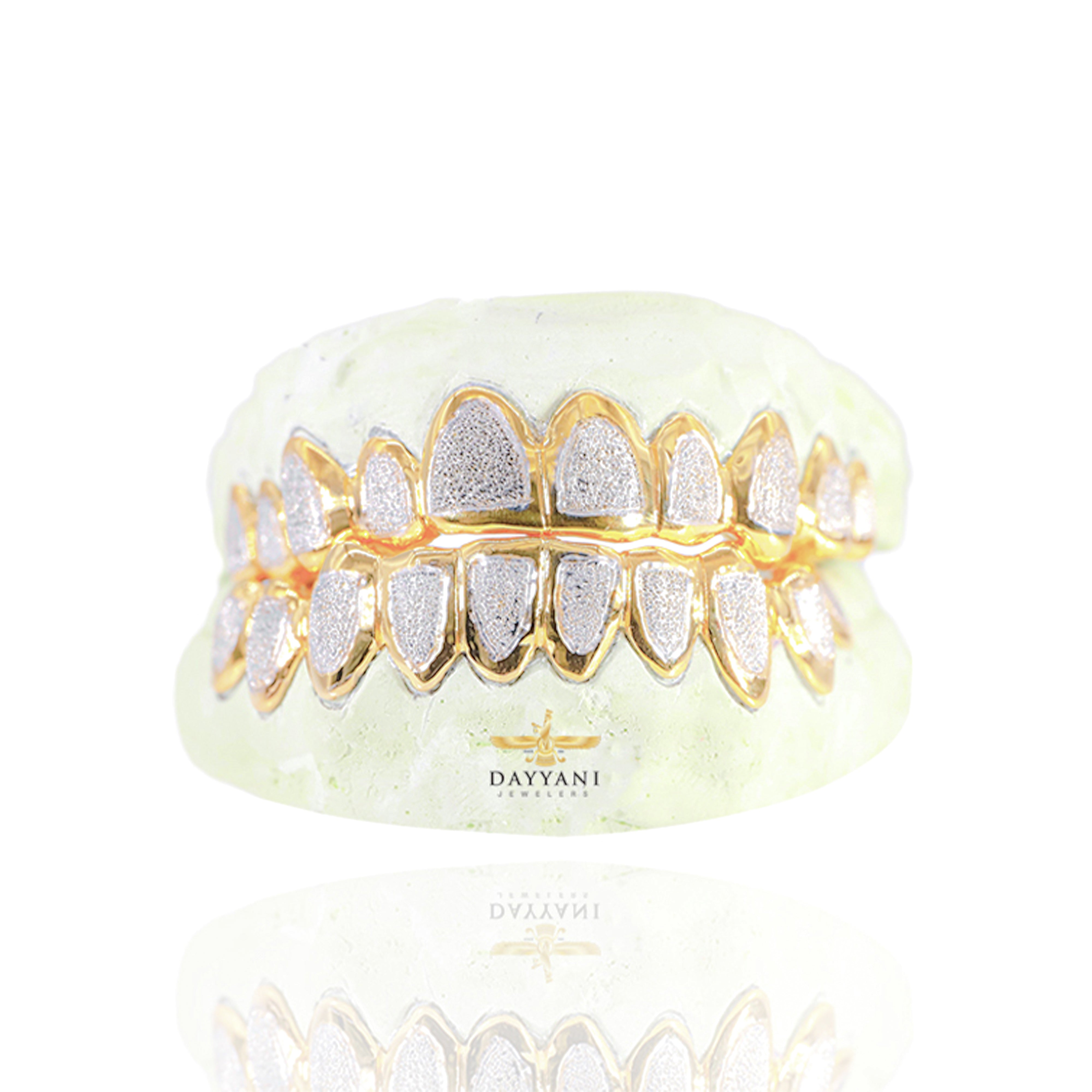 Custom Two-Tone Diamond Dust w/ Solid Trim Gold Grillz