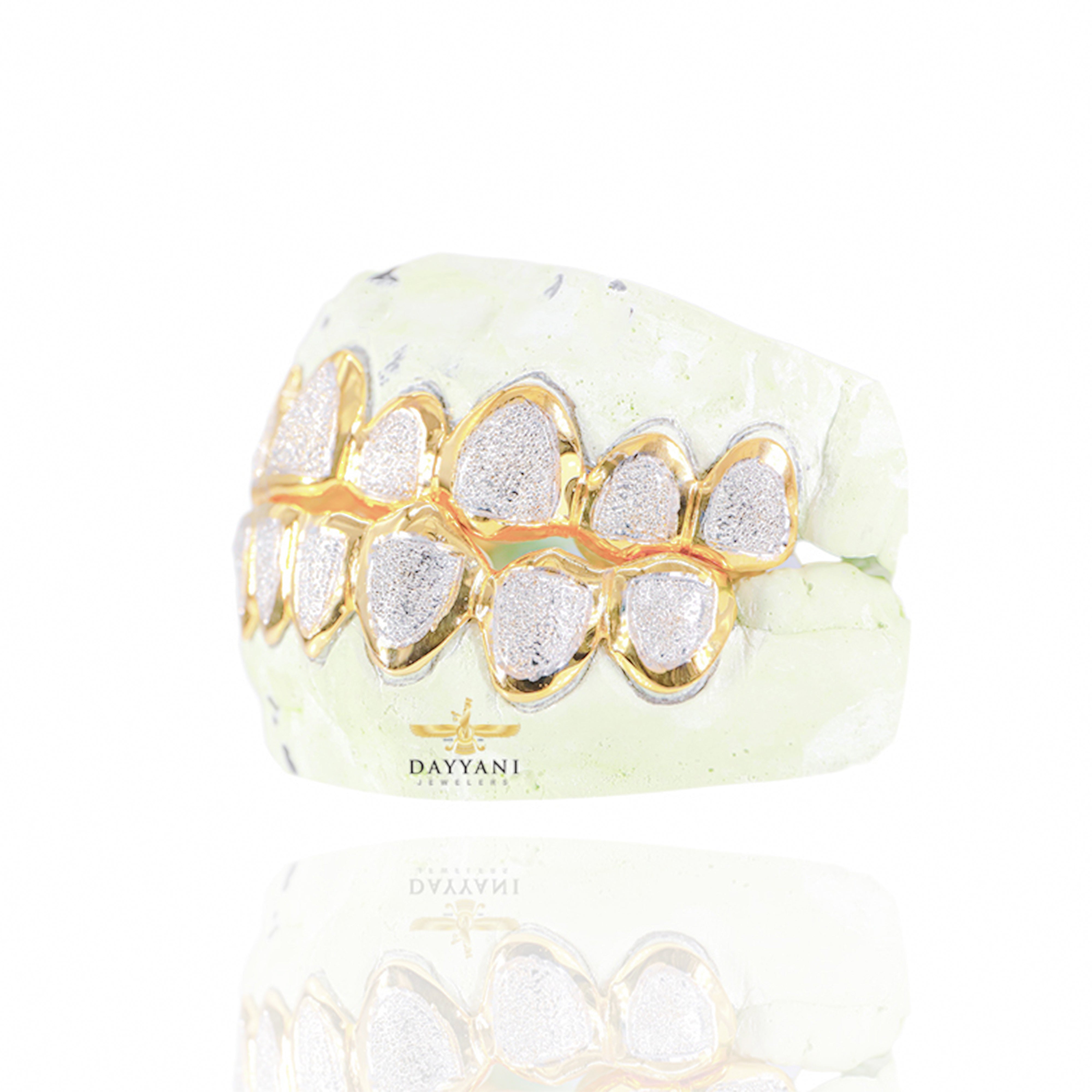 Custom Two-Tone Diamond Dust w/ Solid Trim Gold Grillz