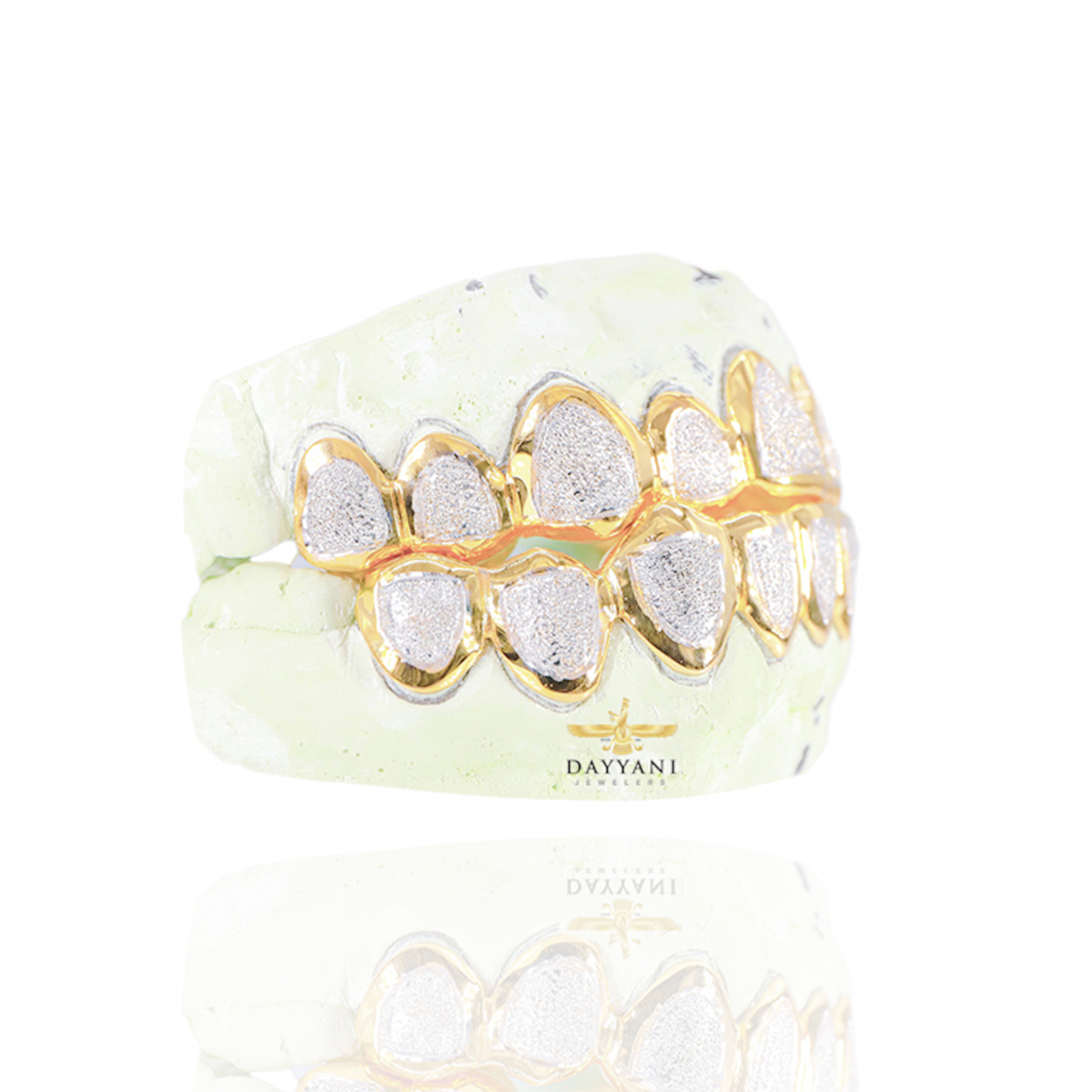 Custom Two-Tone Diamond Dust w/ Solid Trim Gold Grillz
