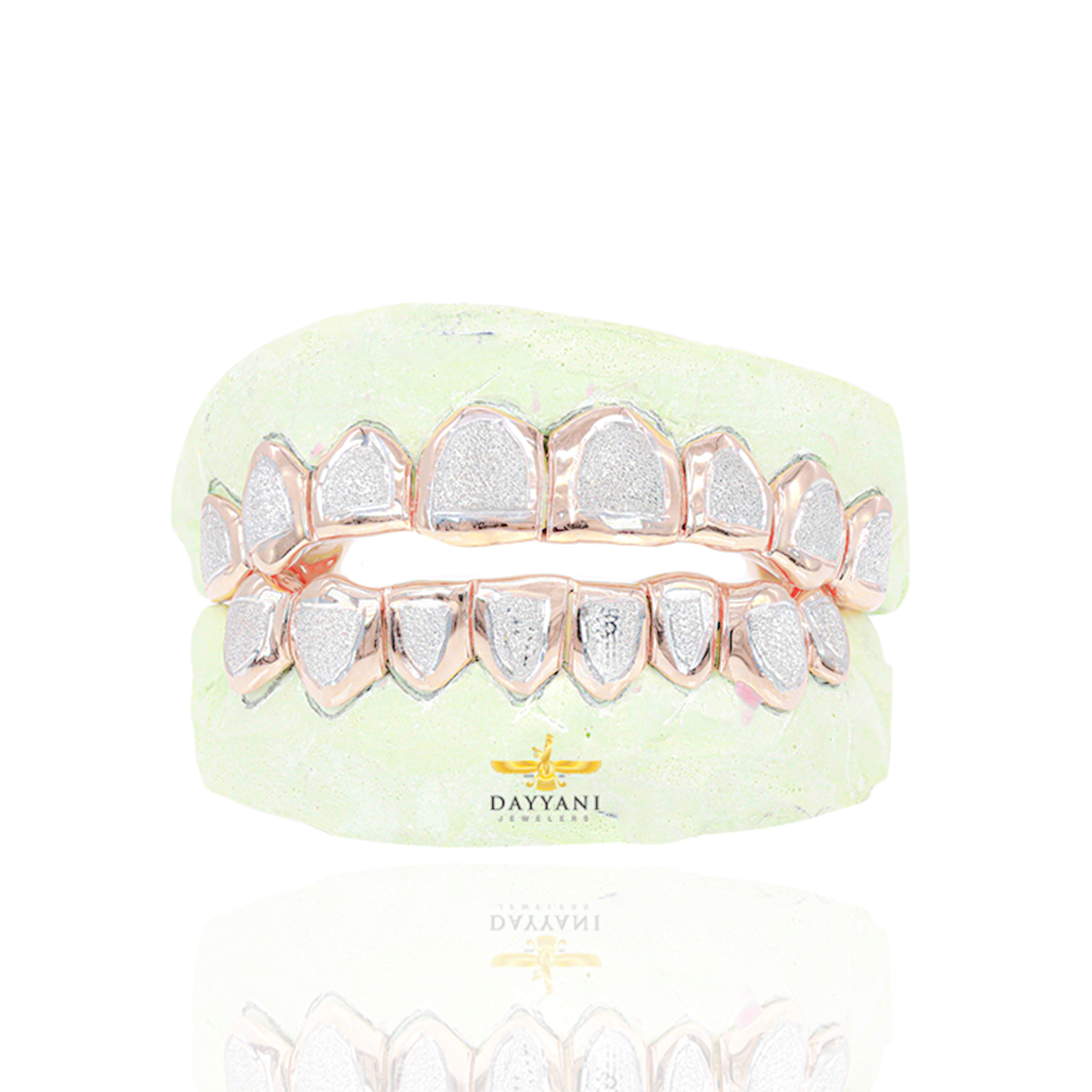 Custom Two-Tone Diamond Dust w/ Solid Trim Gold Grillz