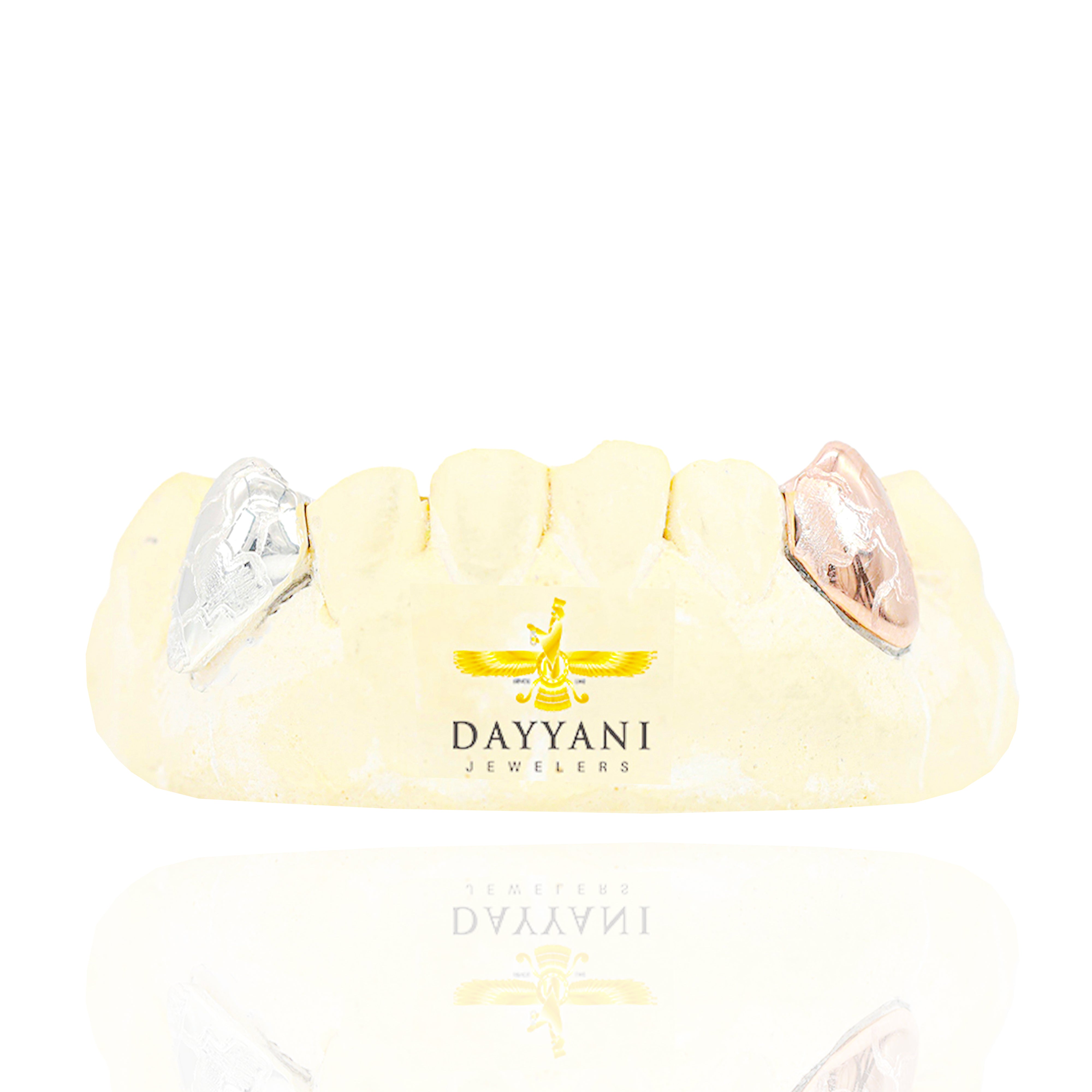 Custom Two-Tone 2 Teeth with Nugget Design Gold Grillz