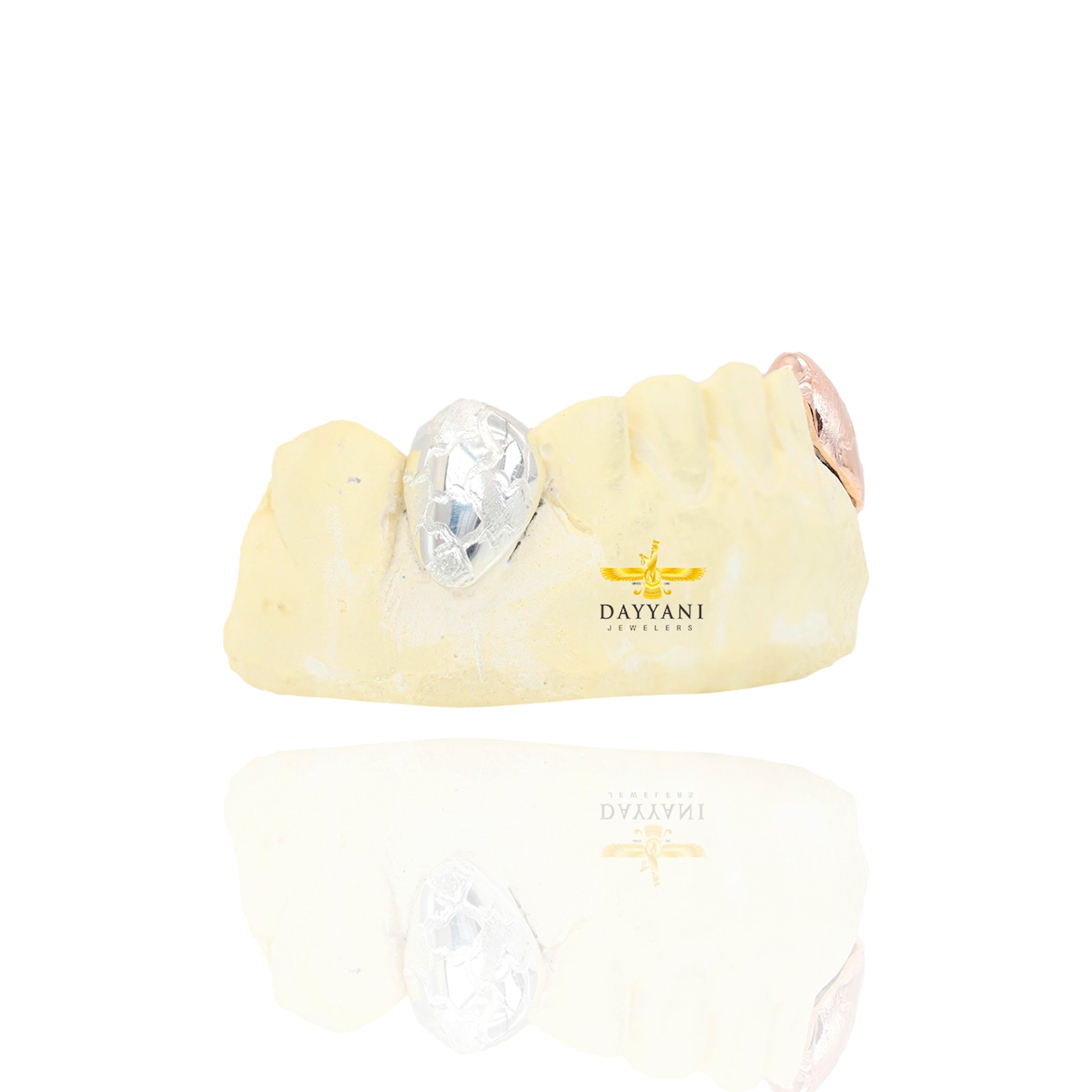 Custom Two-Tone 2 Teeth with Nugget Design Gold Grillz