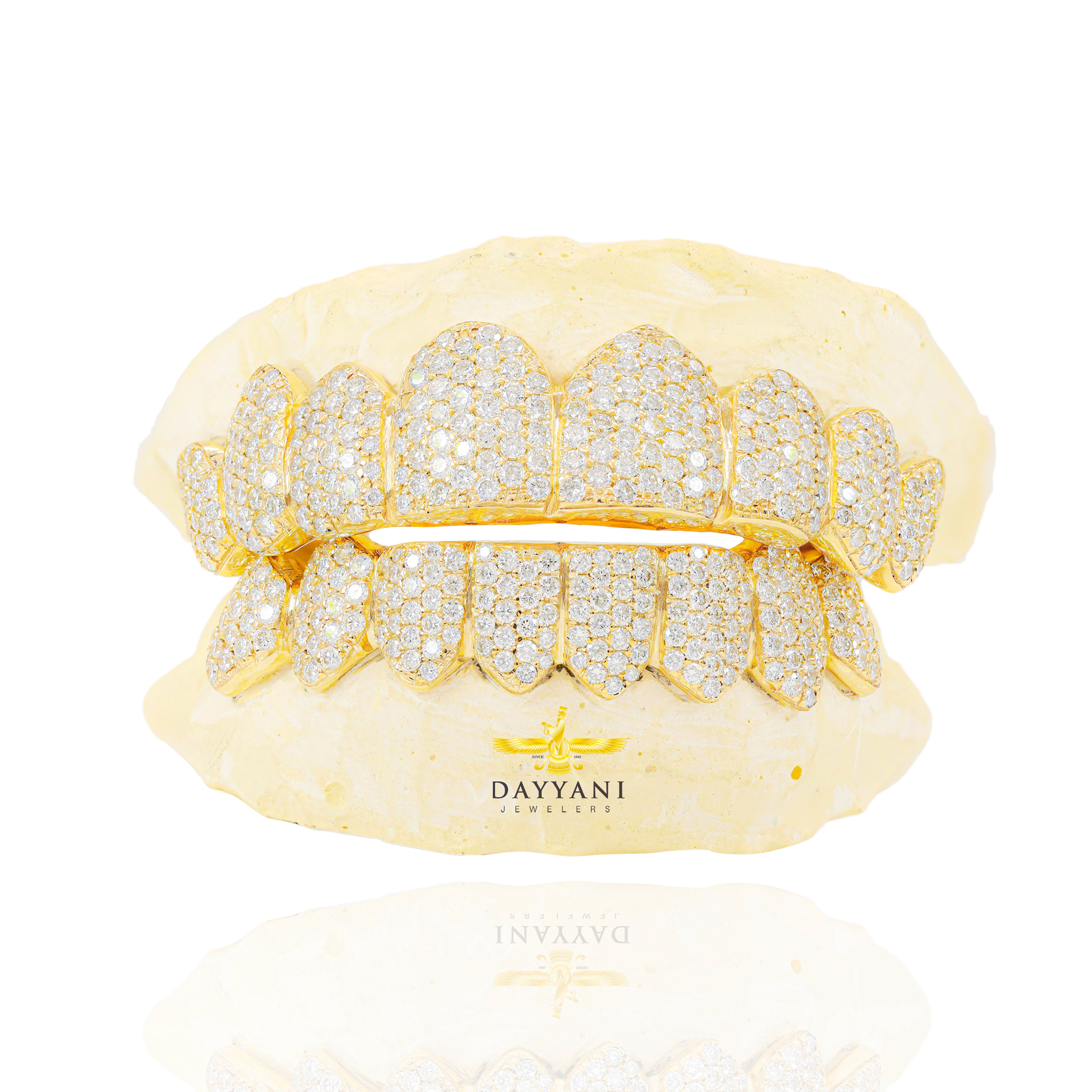 Custom VVS Clarity Diamond Grillz Hand Set Natural Diamonds Gold Grillz (Zig-Zag Setting)