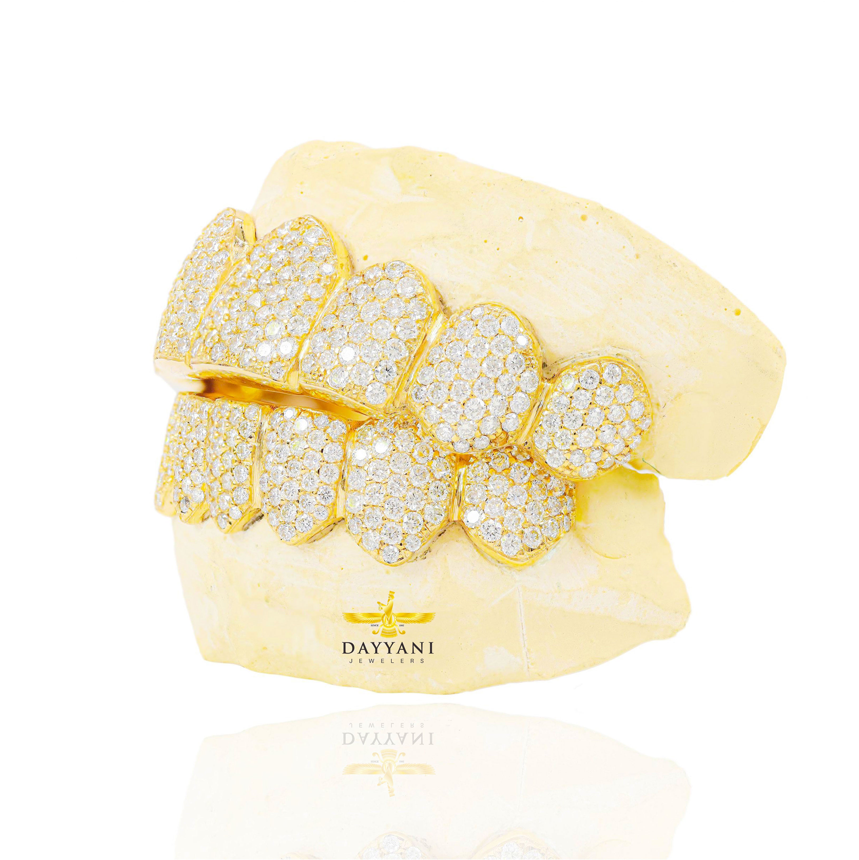 Custom VS Clarity Diamond Grillz Hand Set Natural Diamonds Gold Grillz (Zig-Zag Setting)